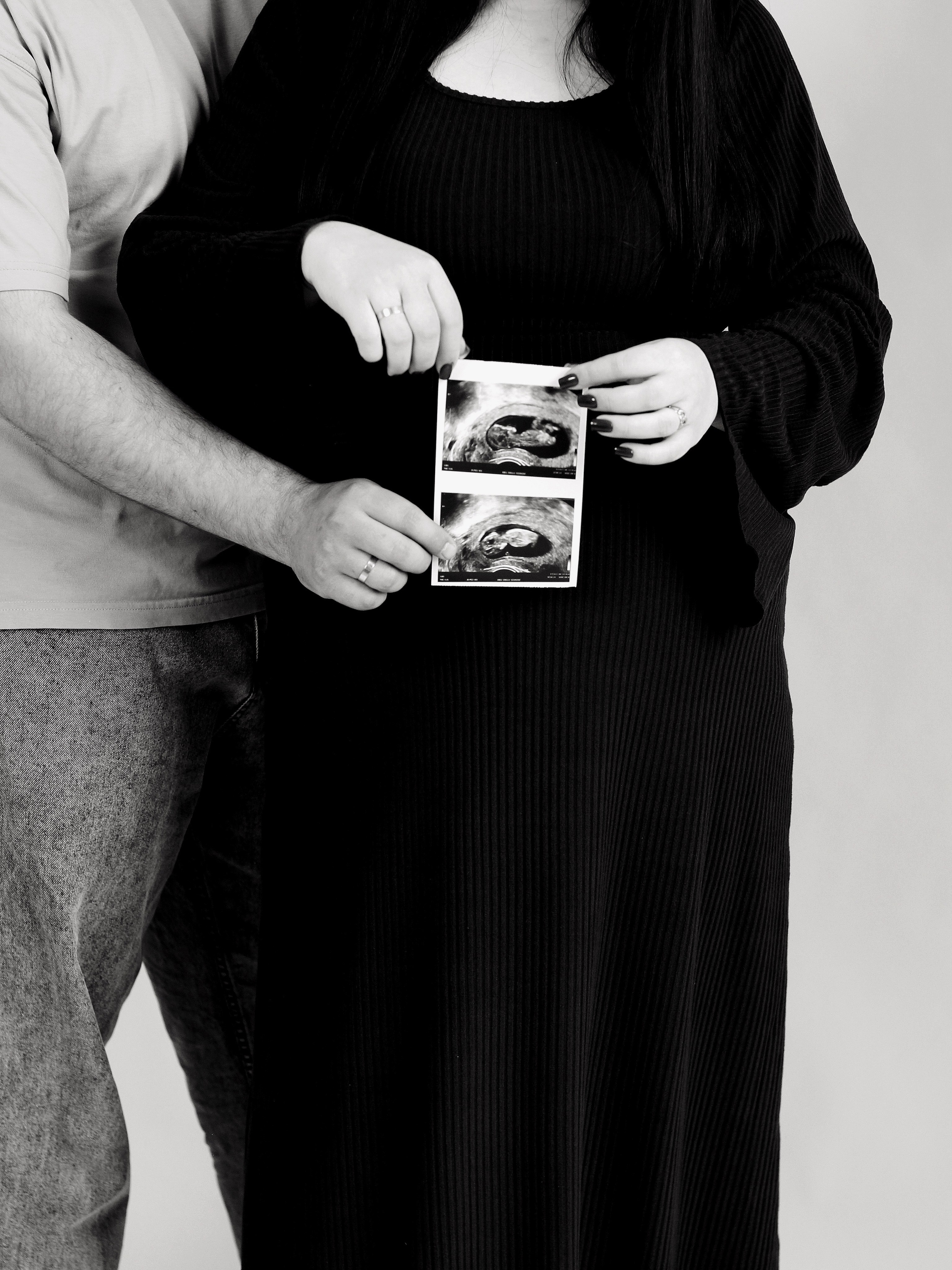 Love story. Photography Eva