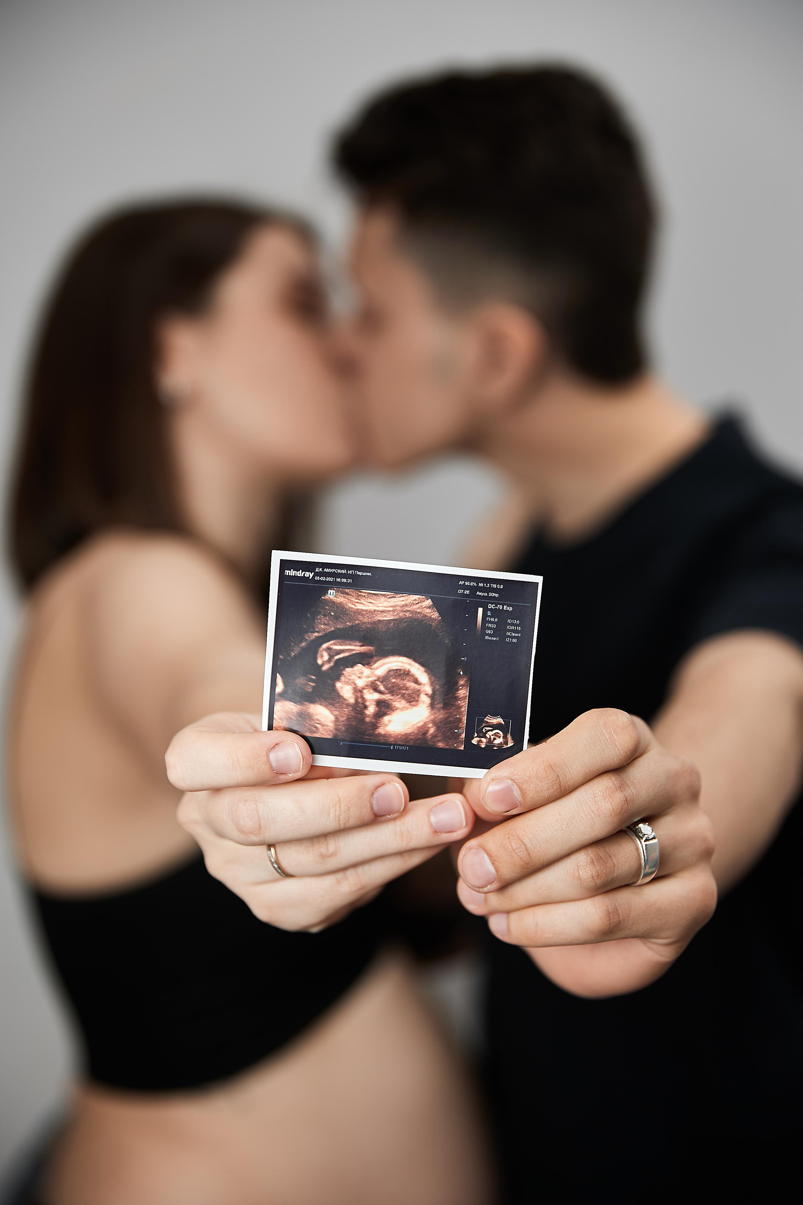 В ожидании чуда. Фотограф Валентин Мельников г. Тында