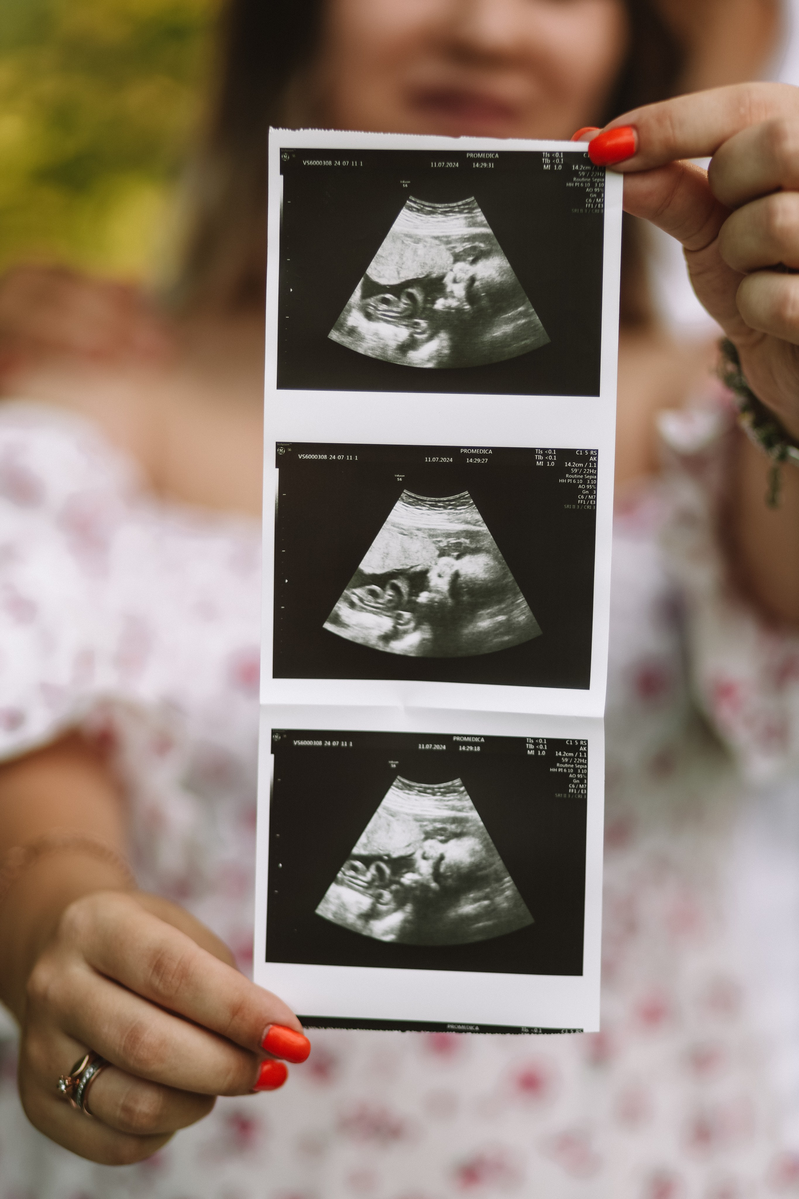 Таня и Рома. О фотографии с душой