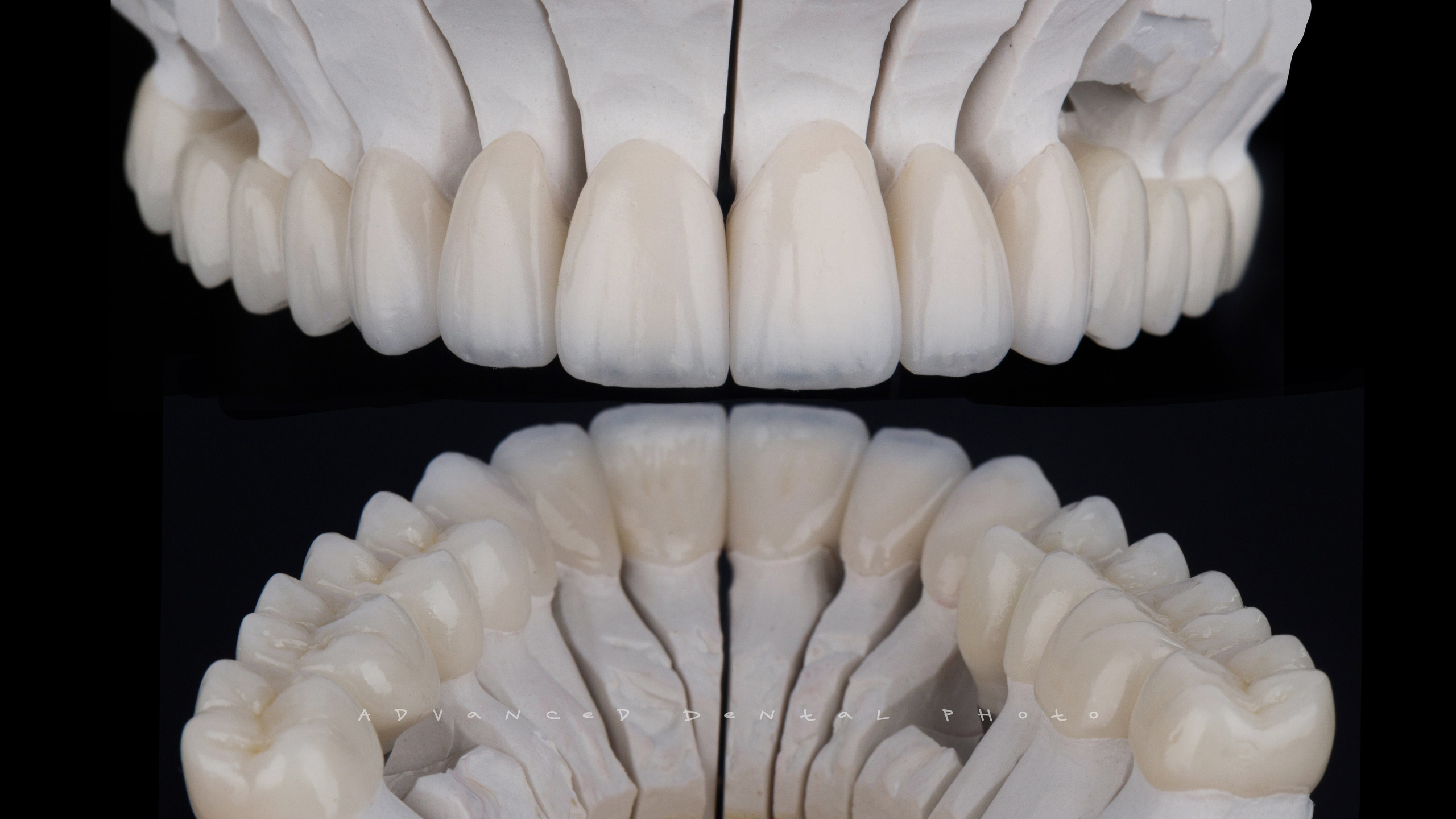 Предметная съёмка. Дентал фотограф — видеограф Денис Дорошенко