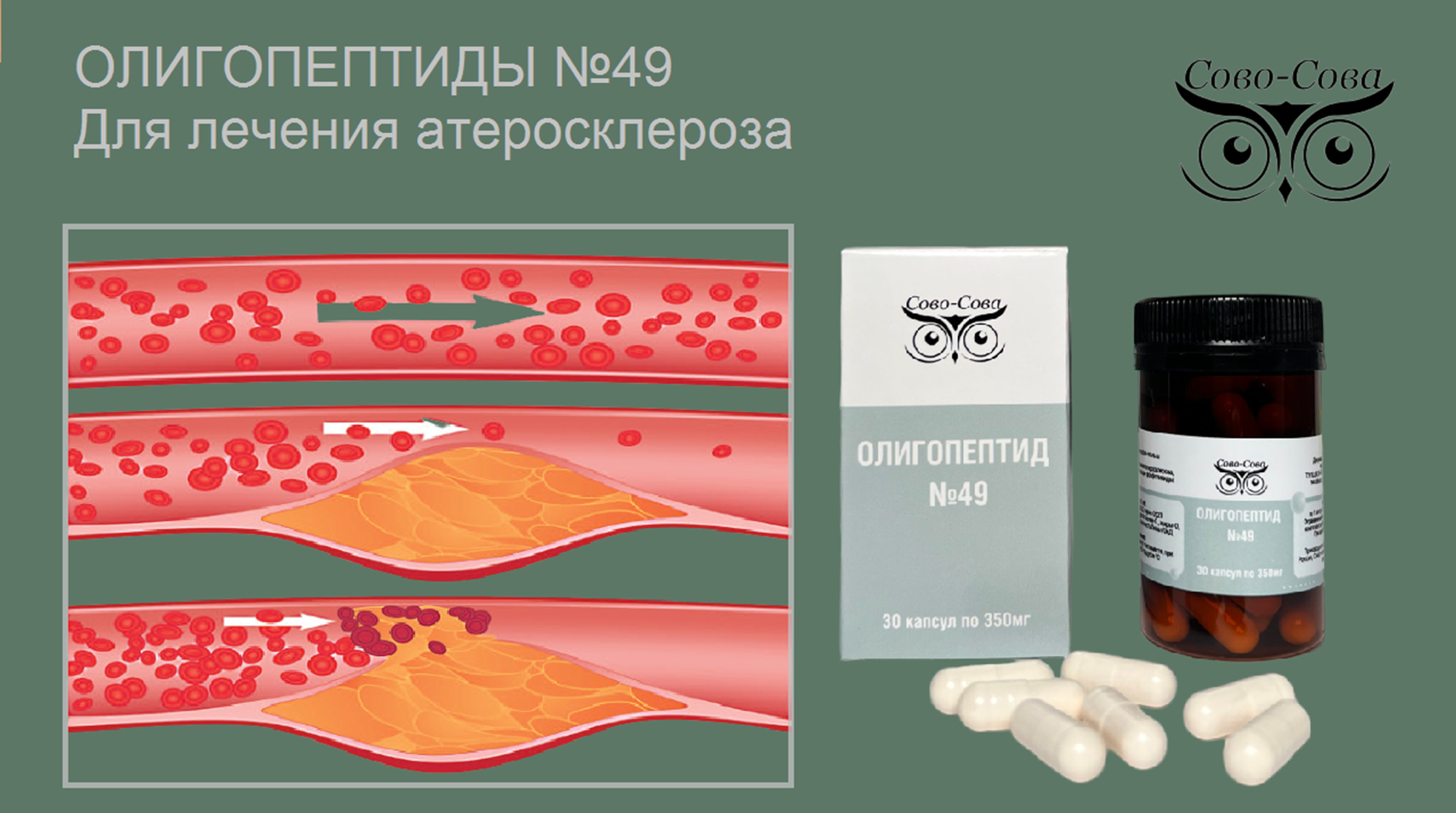 Олигопептид № 49 — Для лечения атеросклероза, инсульта, инфаркта