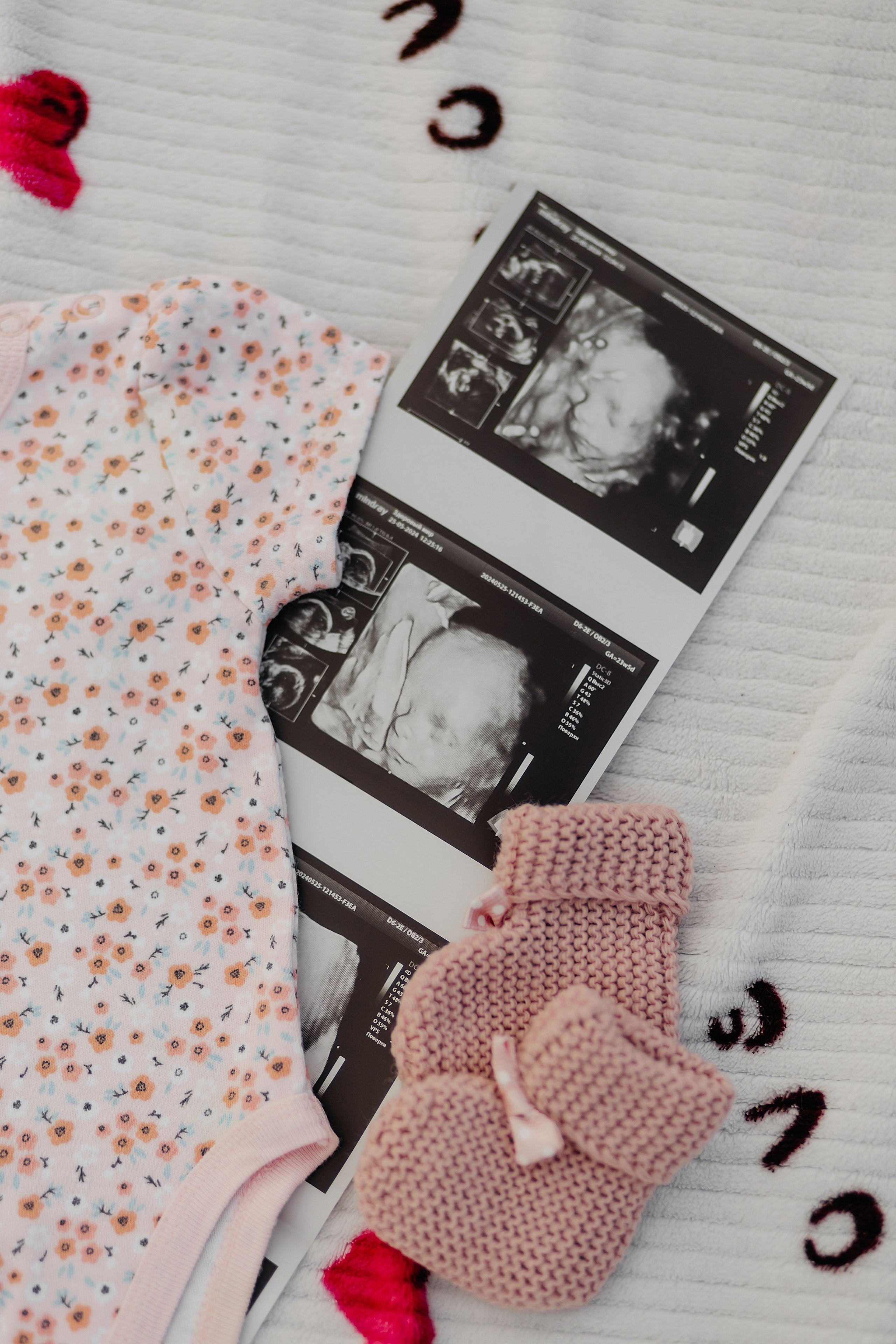 В ожидании. Свадебный фотограф в Пскове и Санкт-Петербурге | Анна Голикова