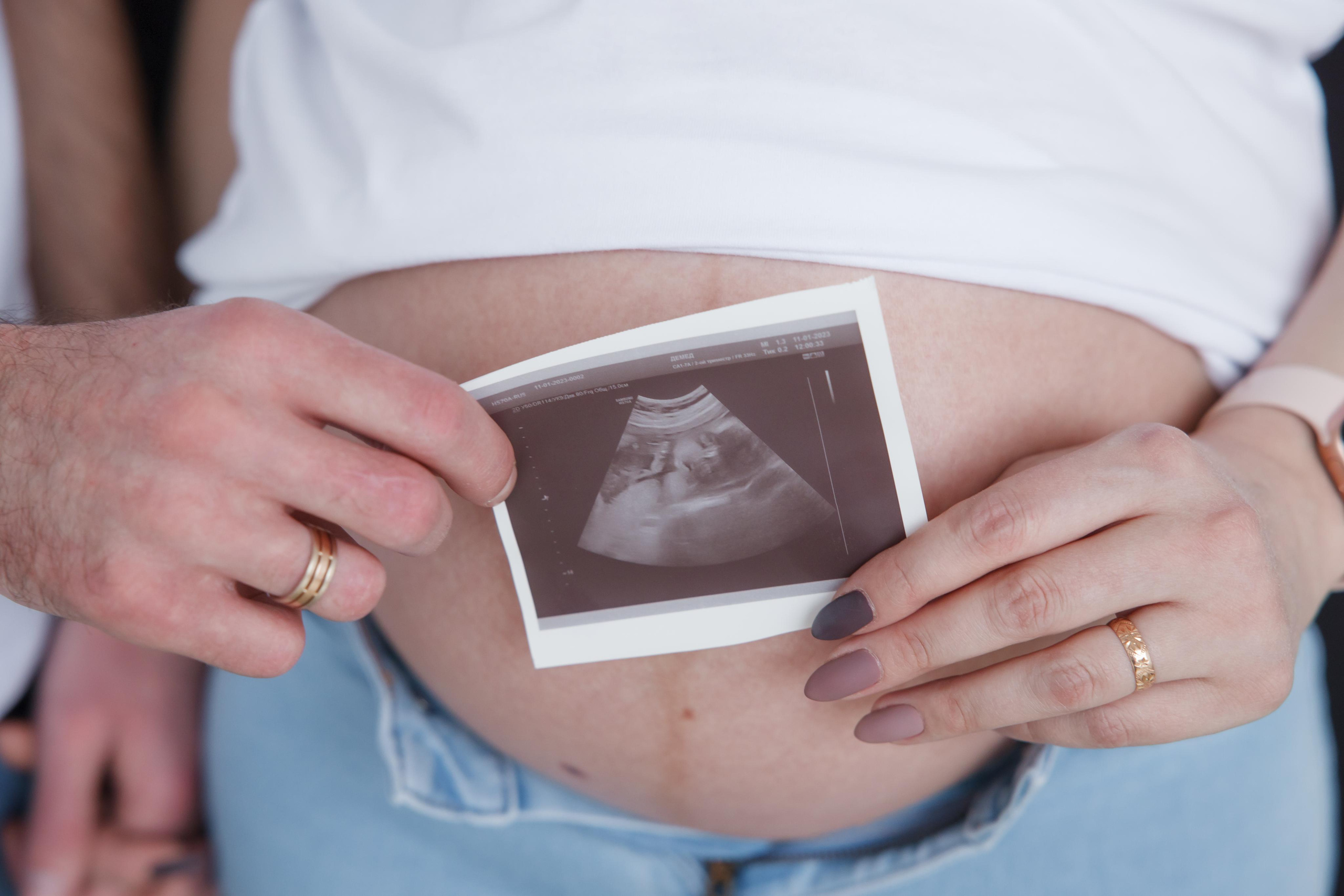 Фотосессия беременности. Свадебный и репортажный фотограф (Москва, Королев и другие)