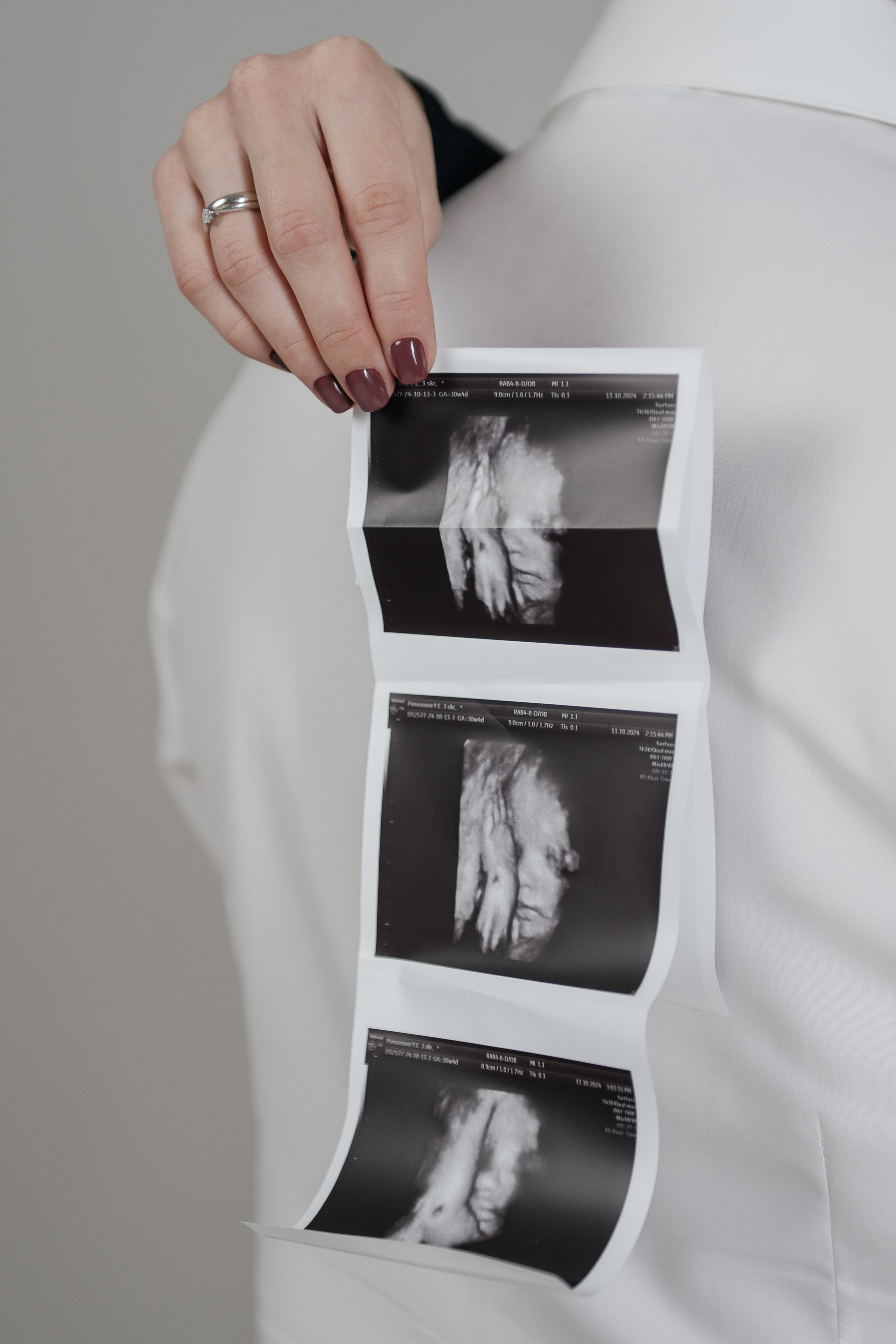 фотосессия беременности в фотостудии на белом фоне циклораме