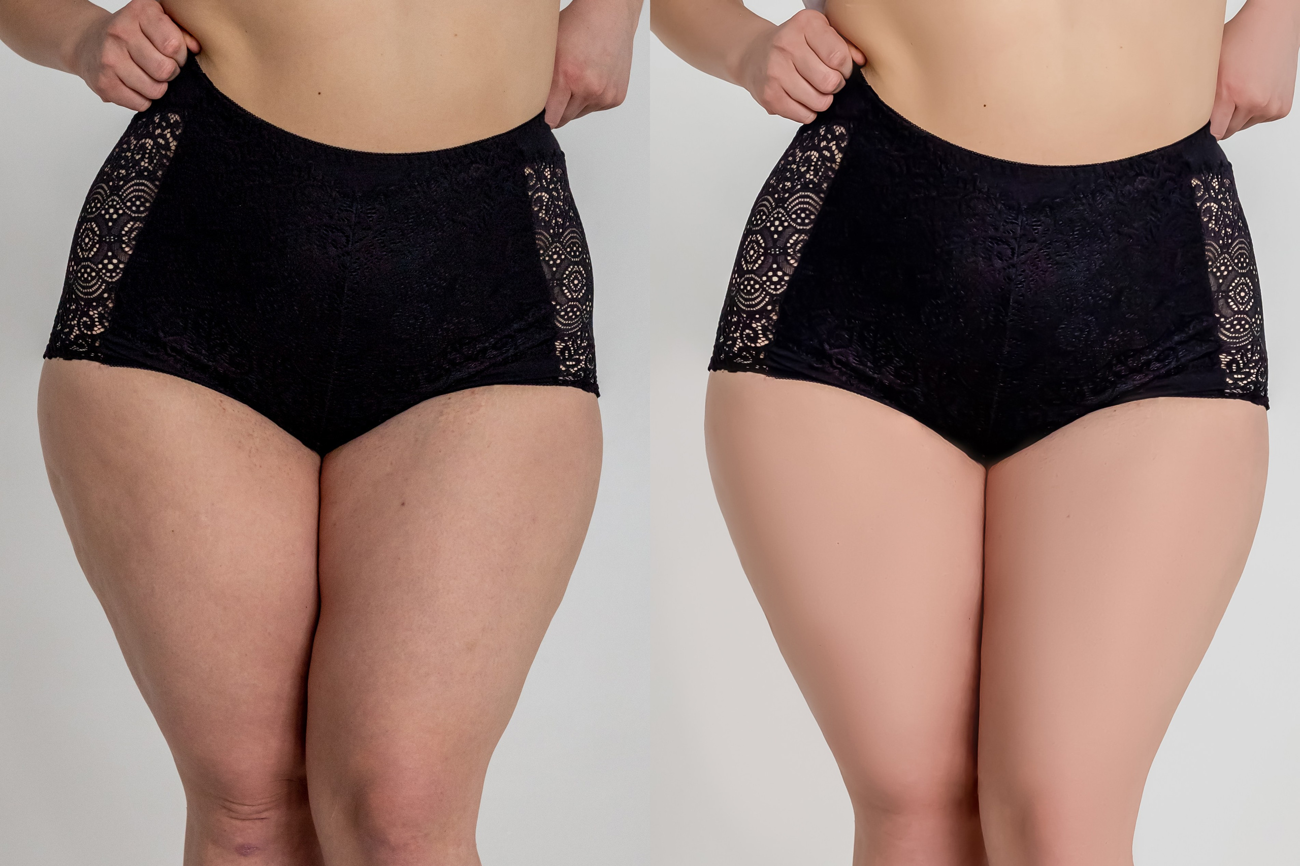 Деликатная обработка портретов для рекламы нижнего белья | Студия SVITHART