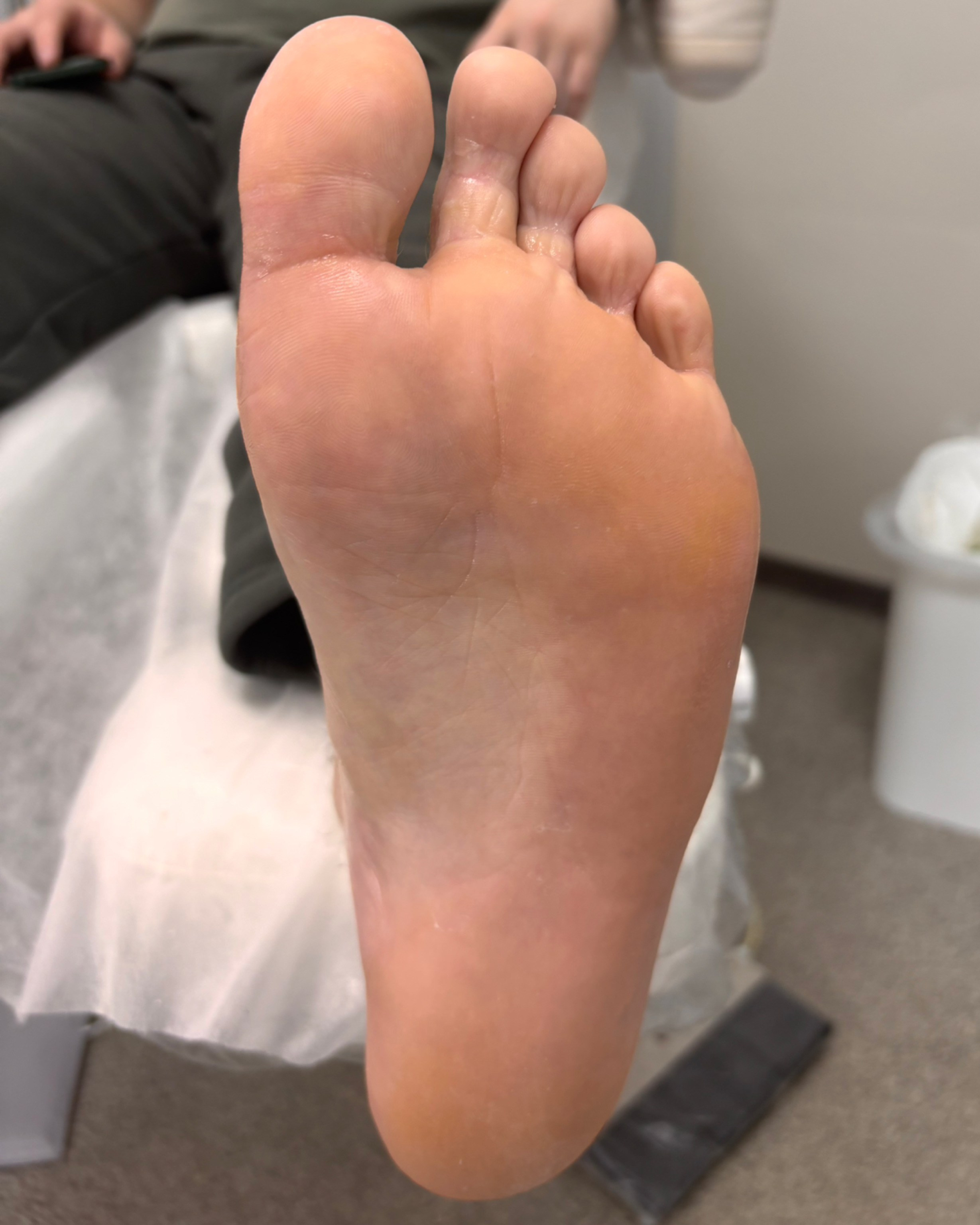 Обработка стопы при грибке. Подолог г. Хабаровск — центр здоровой стопы «FOOTTIME»