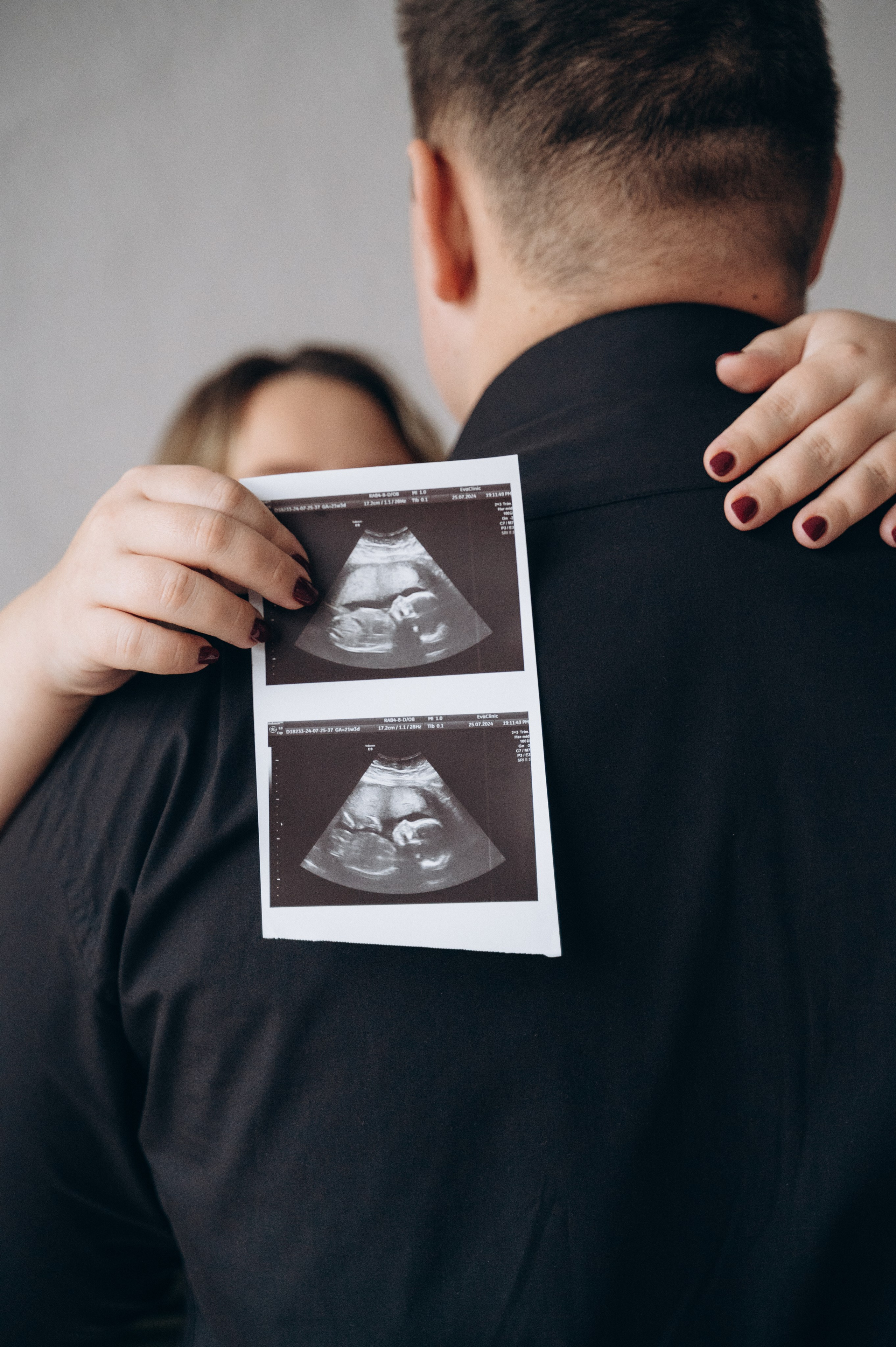 Виктория и Влад — в ожидании чуда. Семейный фотограф в Минске Дарья Дреко