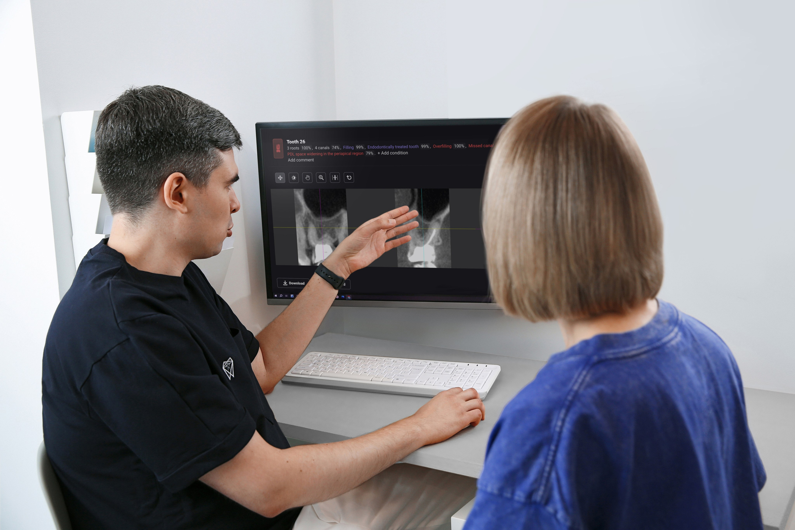 Консультация врача стоматолога с помощью искусственного интеллекта Diagnocat