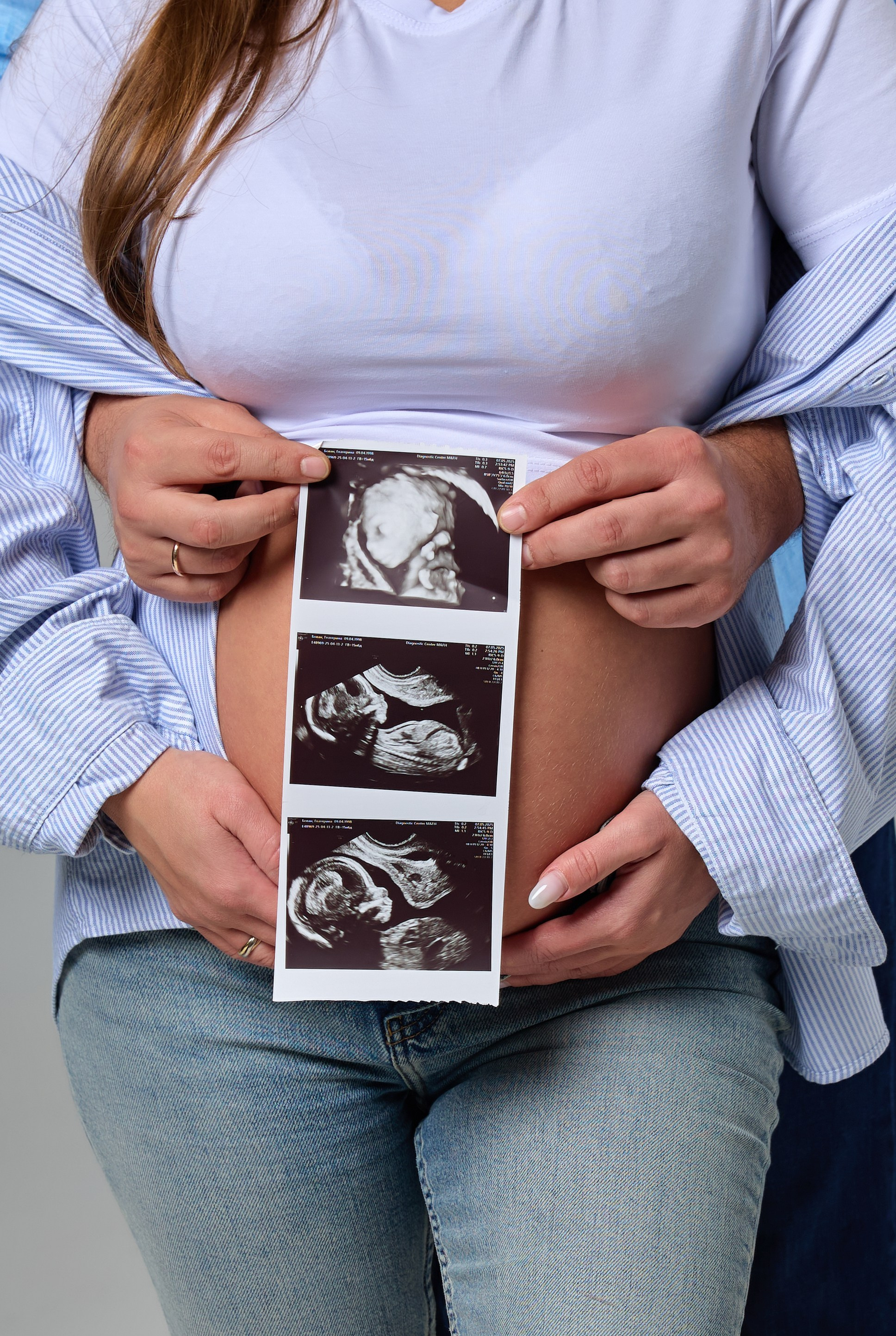 Катерина. Pregnancy. Фотограф Люся Воробьева