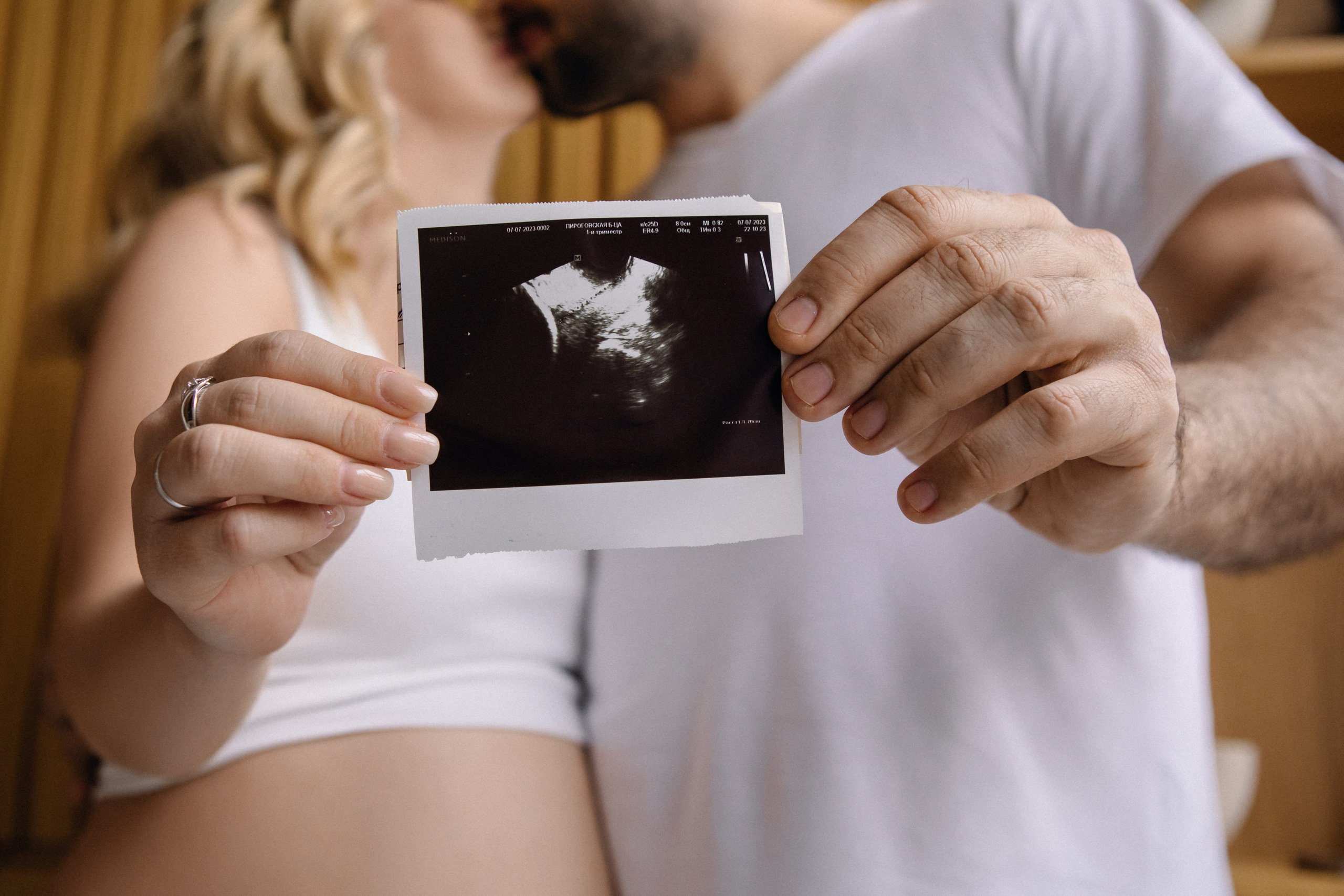 Узи малыша фото беременности детали