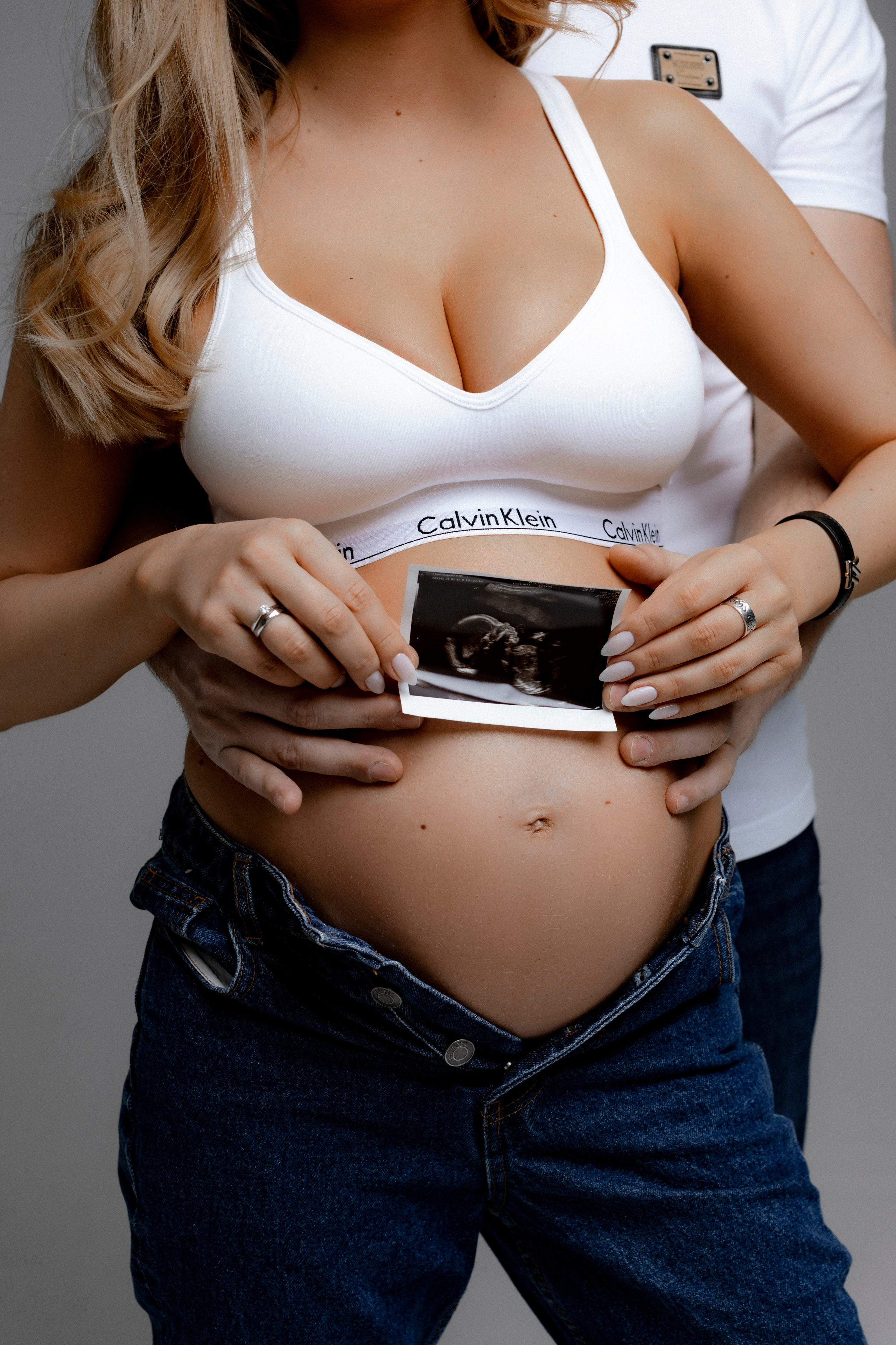 Красивая беременность фото узи