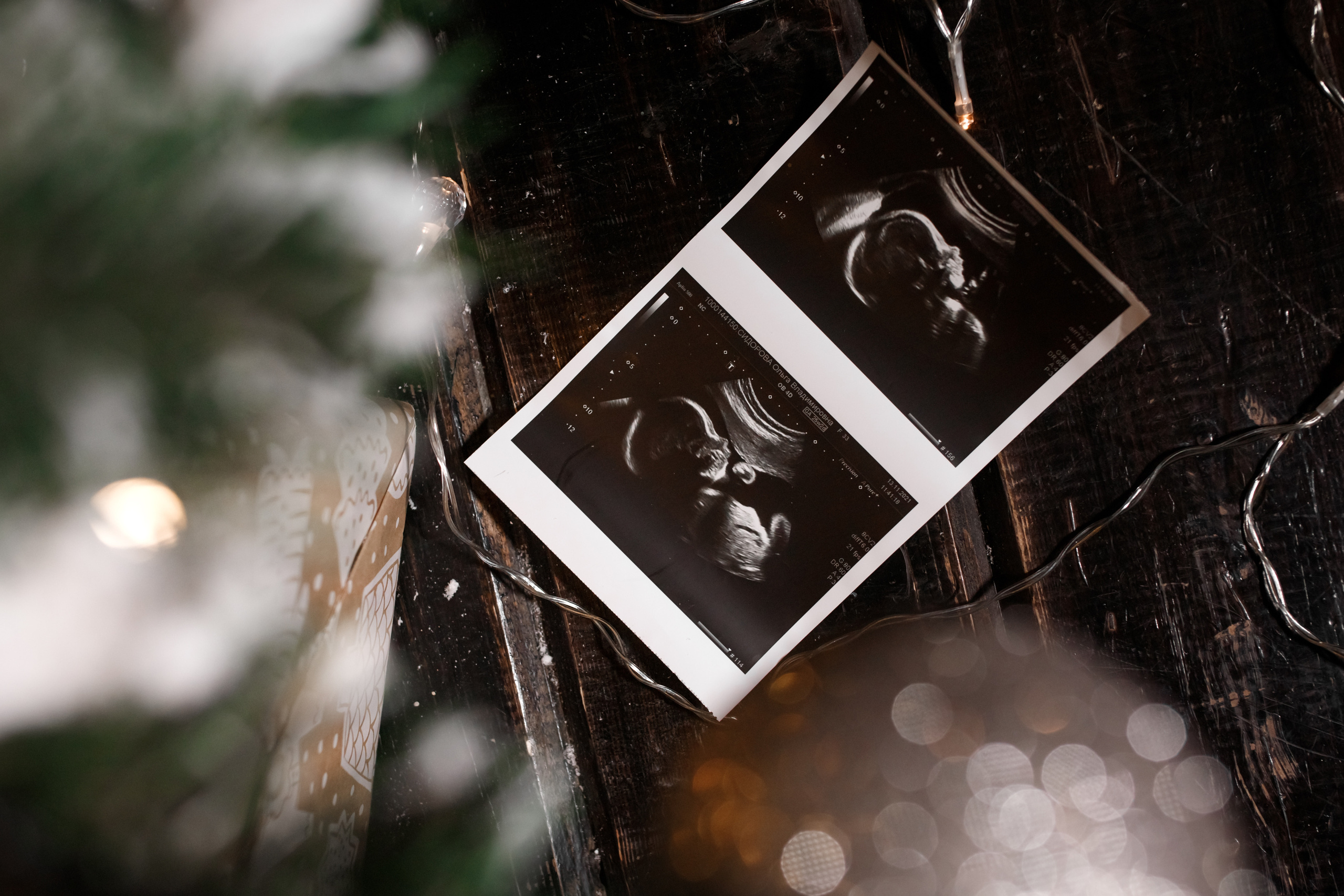 Съемка беременности. Семейный и детский фотограф Егорьевск