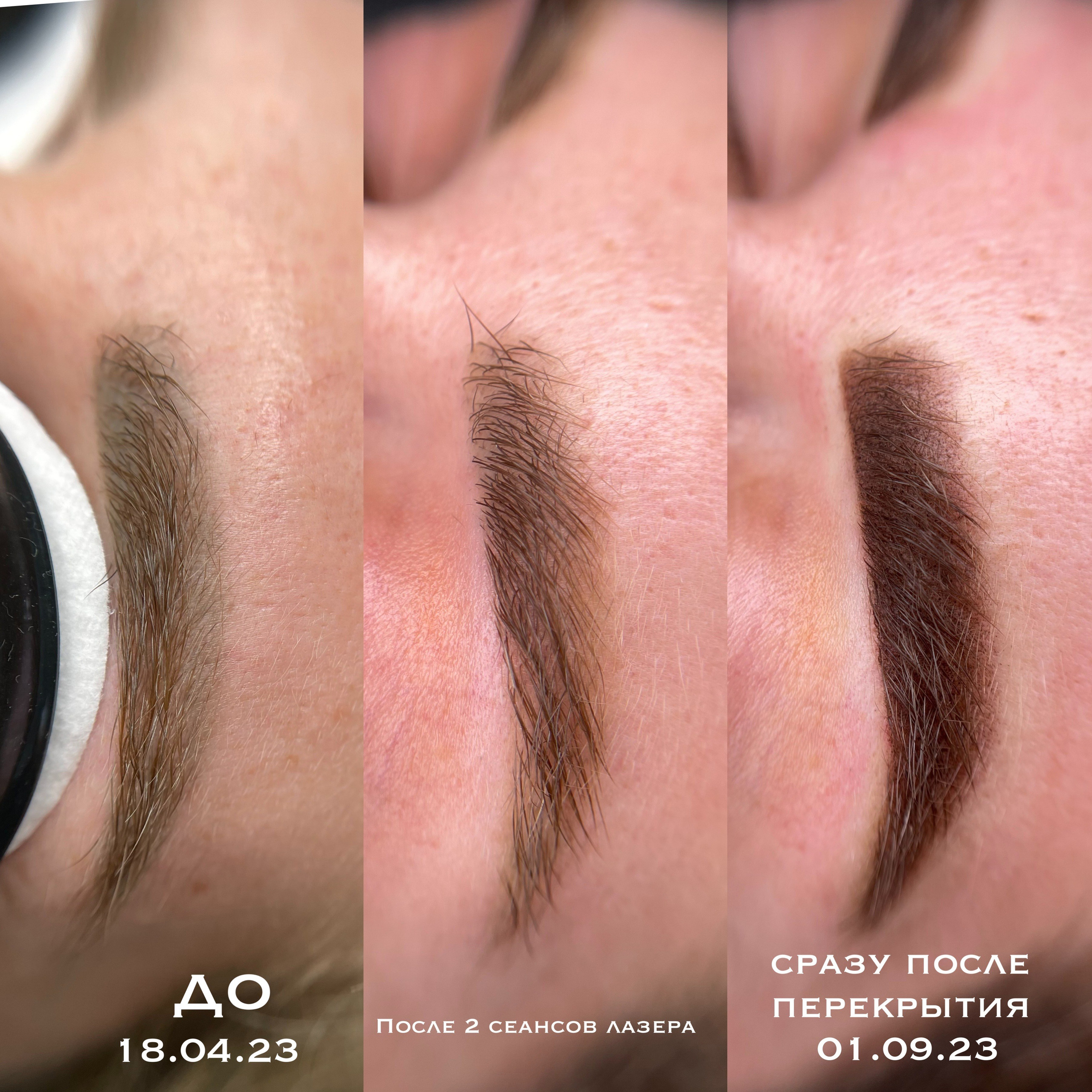 УДАЛЕНИЕ СТАРОГО ТАТУАЖА. Перманентный макияж и удаление старого татуажа в Ростове-на-Дону Дарья Исакова