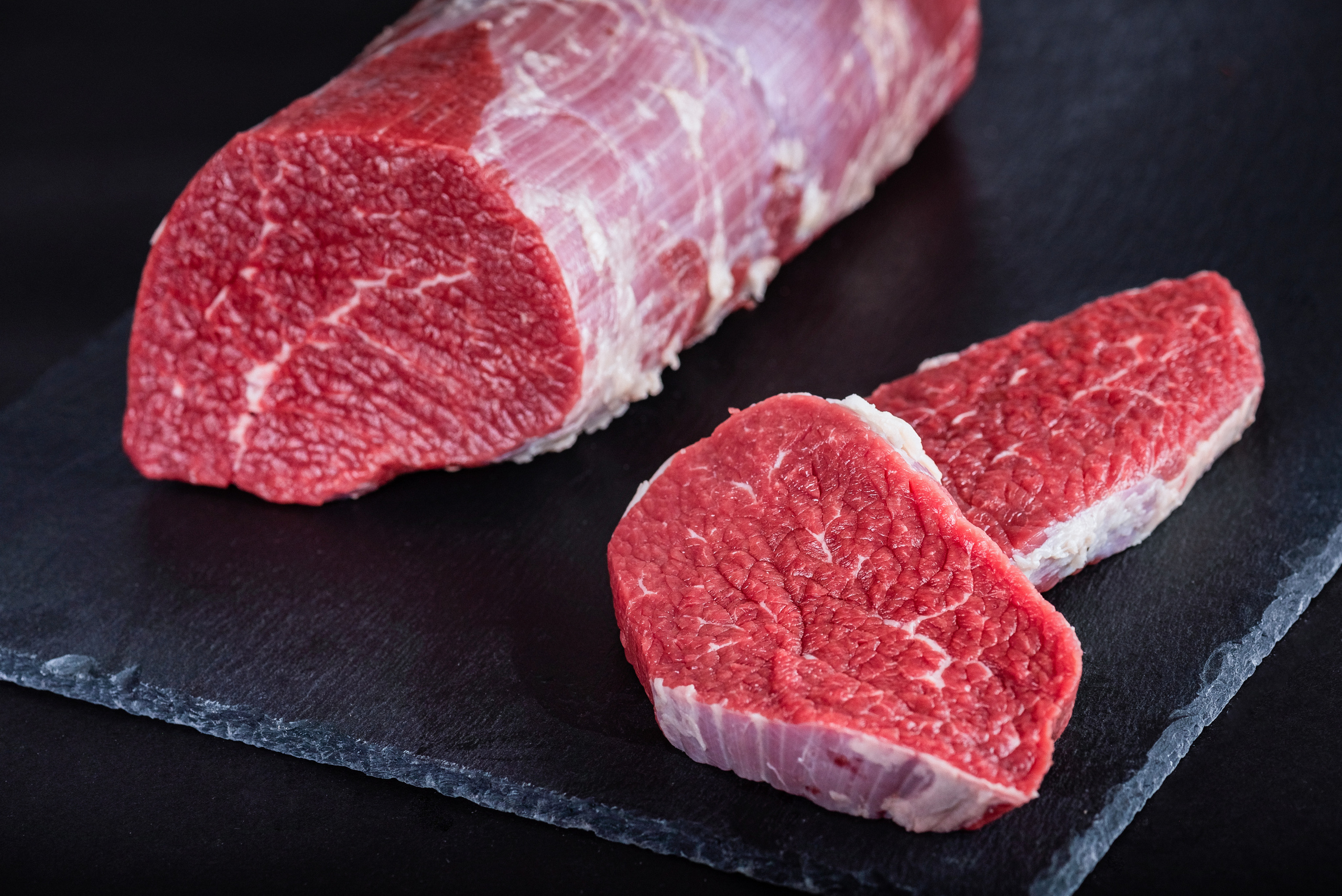 Глазной мускул