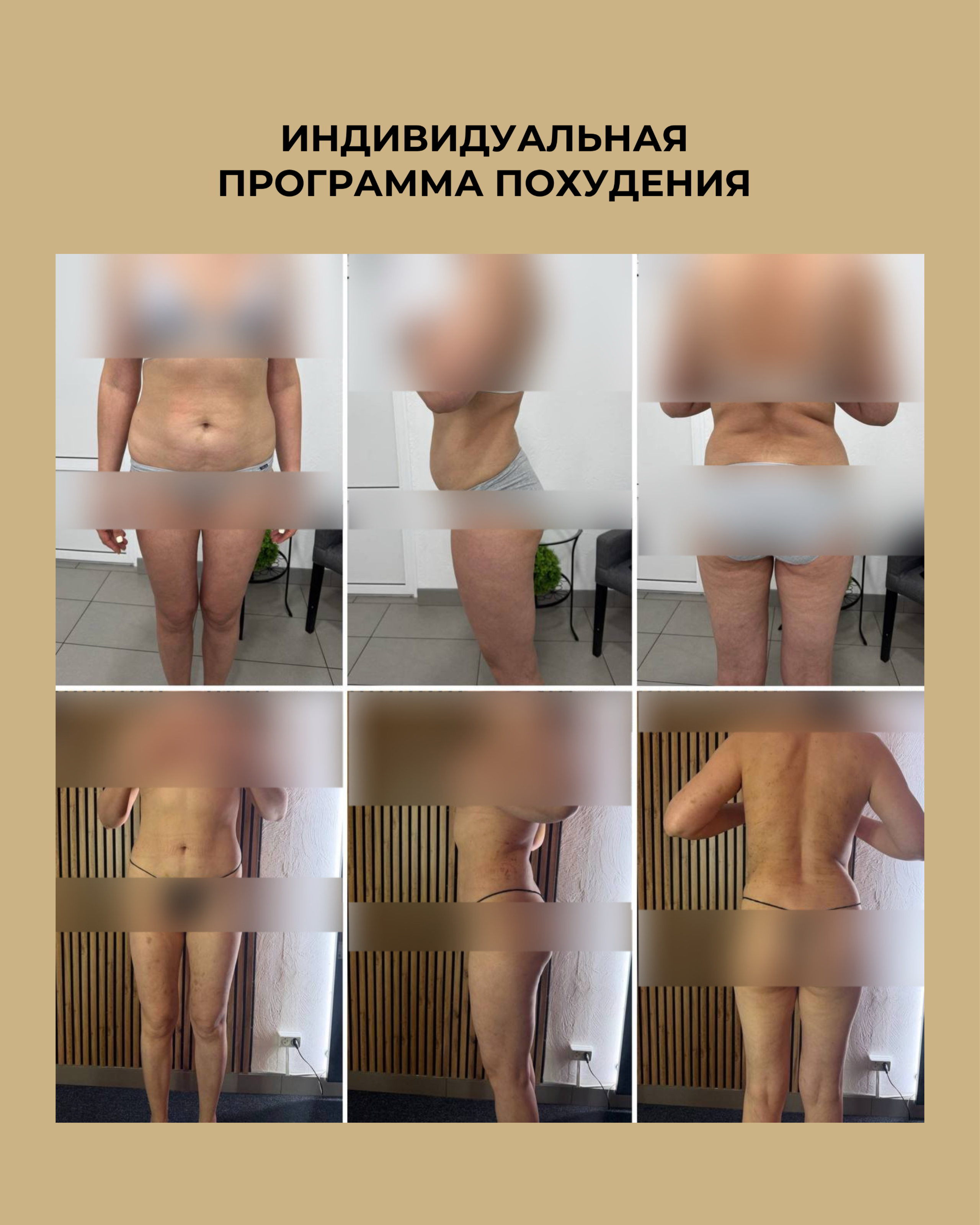 РЕЗУЛЬТАТЫ КЛИЕНТОВ ДО/ПОСЛЕ. Центр аппаратной косметологии IVI