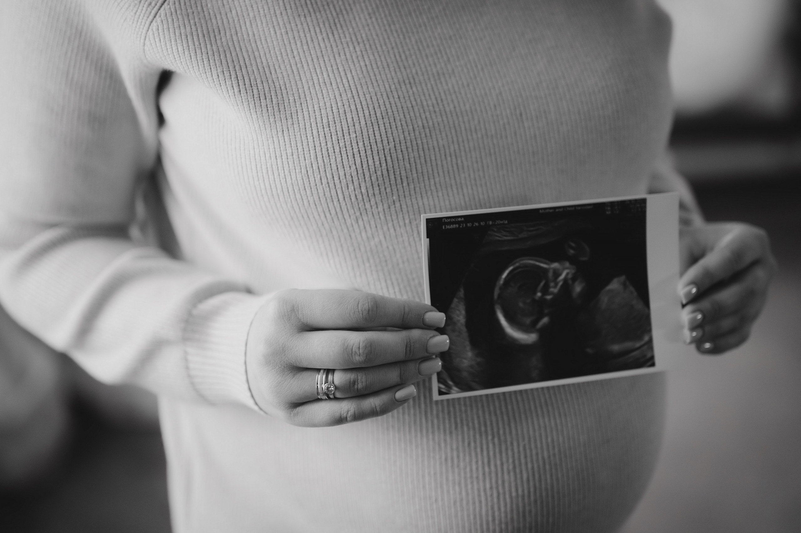 В ожидании. Студийное ЧБ. Фотограф в Переславле-Залесском Алексей Погосов
