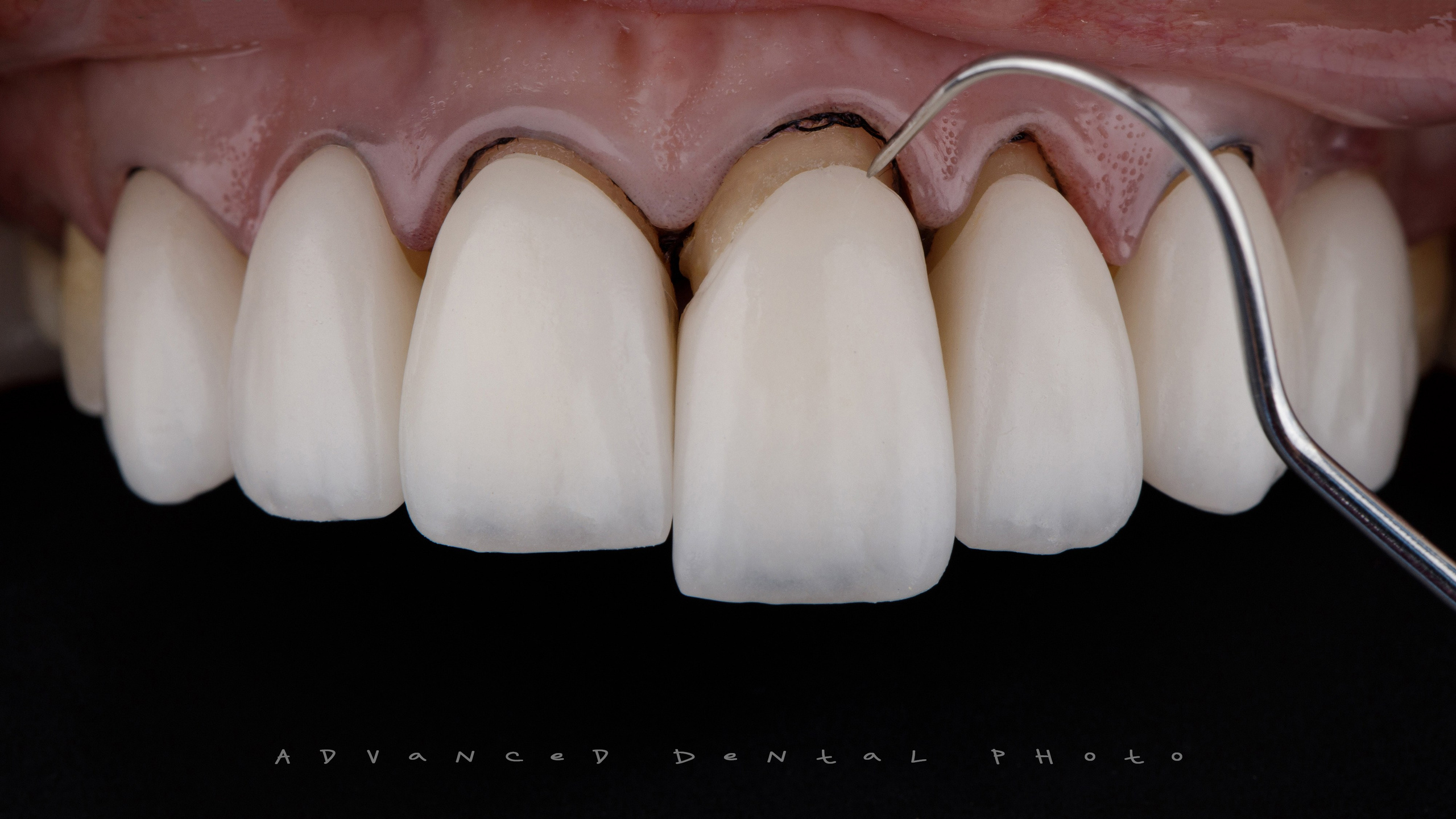 Ортопедия. Дентал фотограф — видеограф Денис Дорошенко