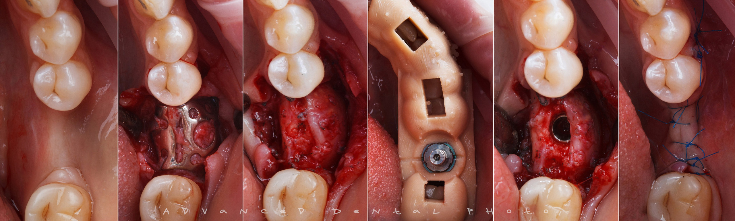 Хирургия. Дентал фотограф — видеограф Денис Дорошенко