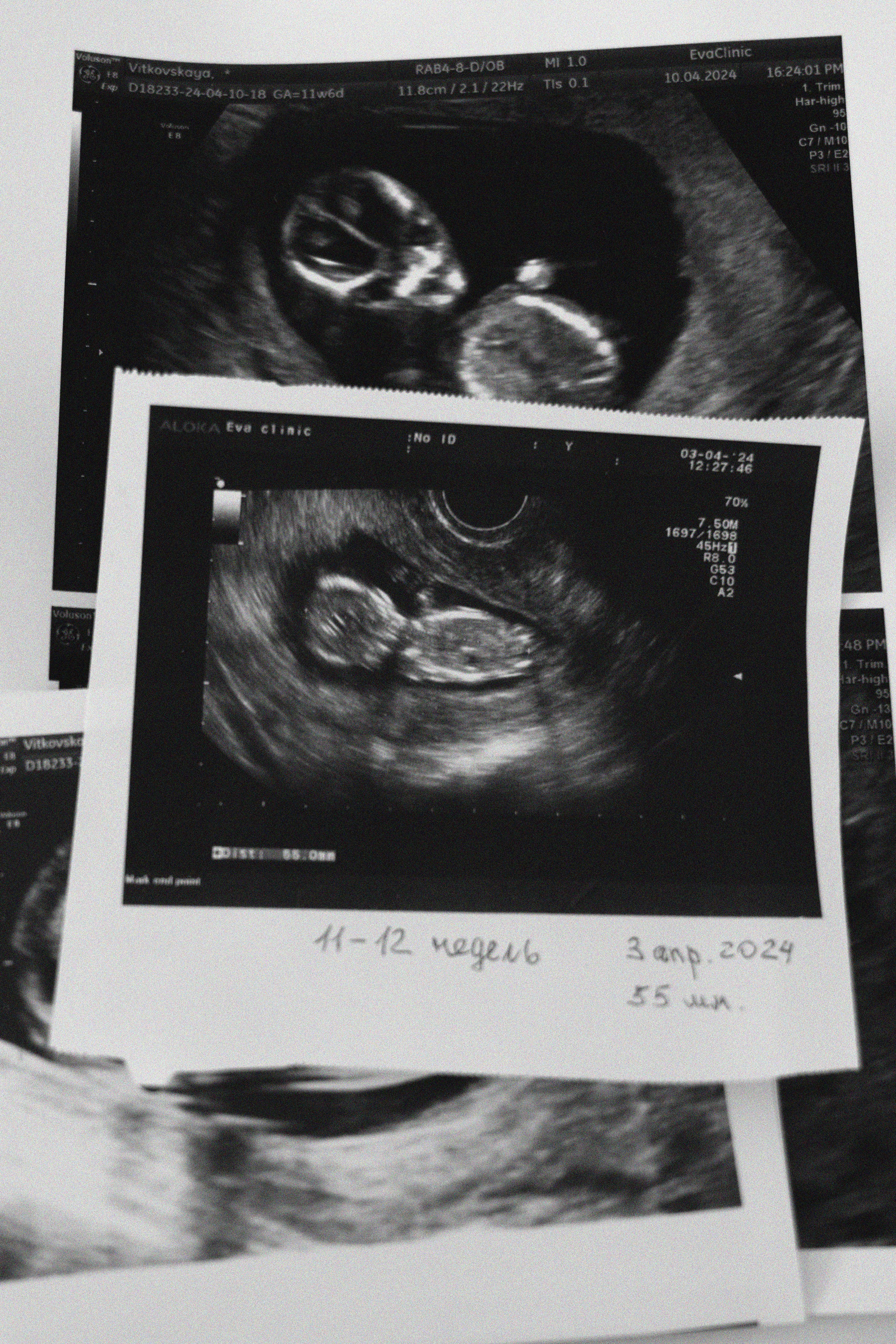 Первые дни жизни Лёшки. Фотограф видеограф Ольга Василевская