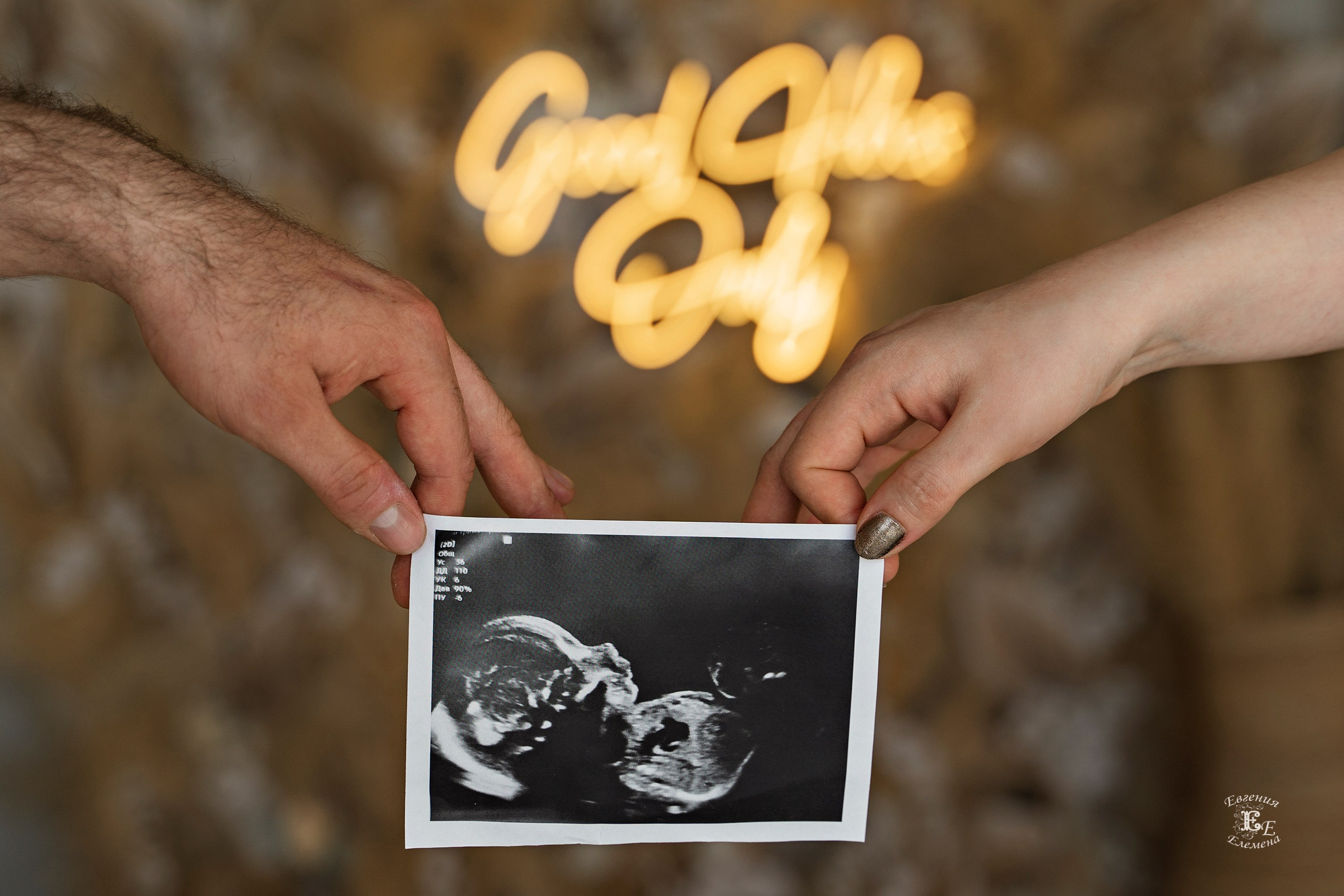 Фотосессия Елены и Антона «Ожидание малыша». Семейный и портретный фотограф в Санкт-Петербурге Евгения Елемена