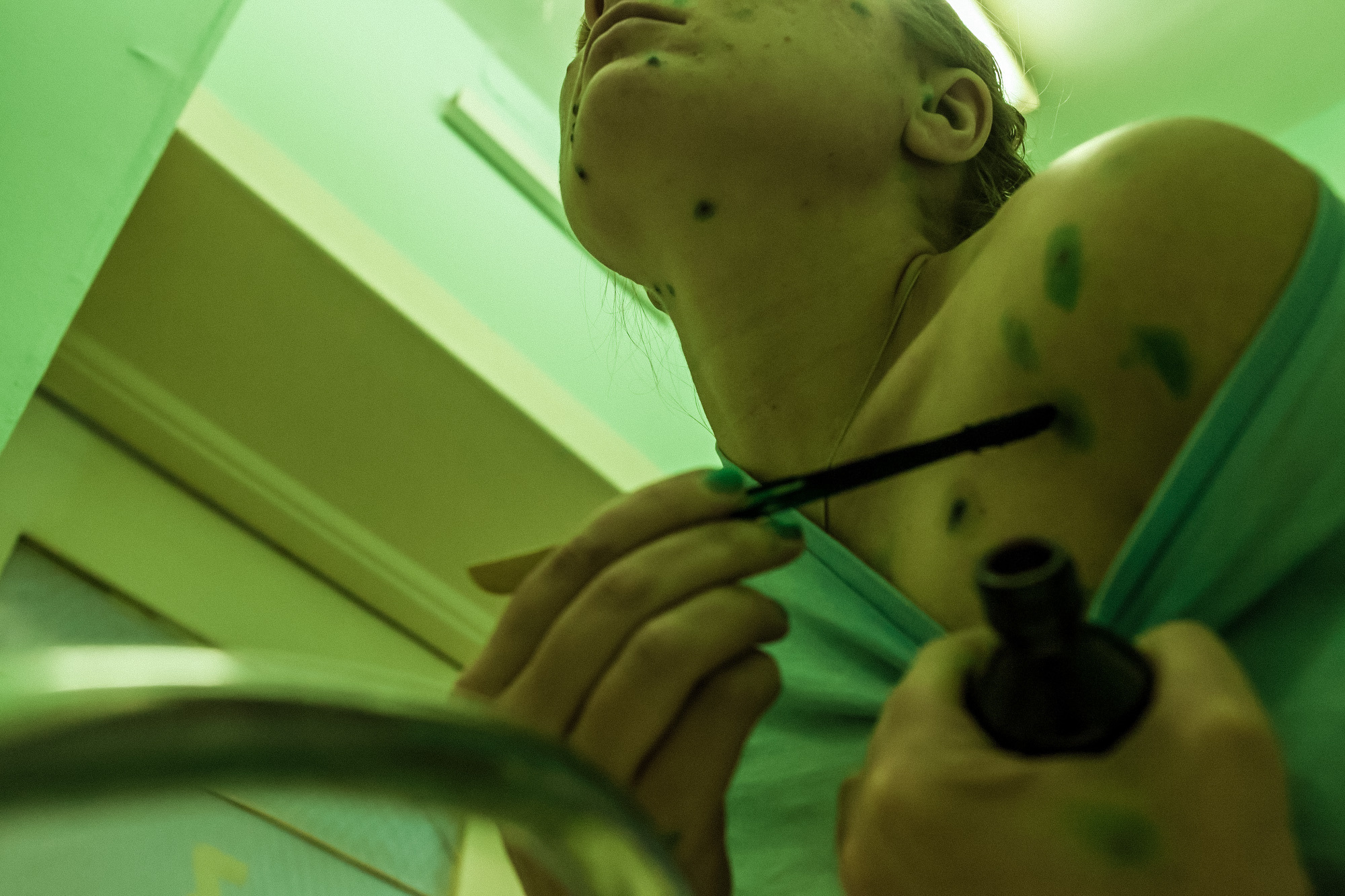 CHICKENPOX. Evgeniya Kokurina