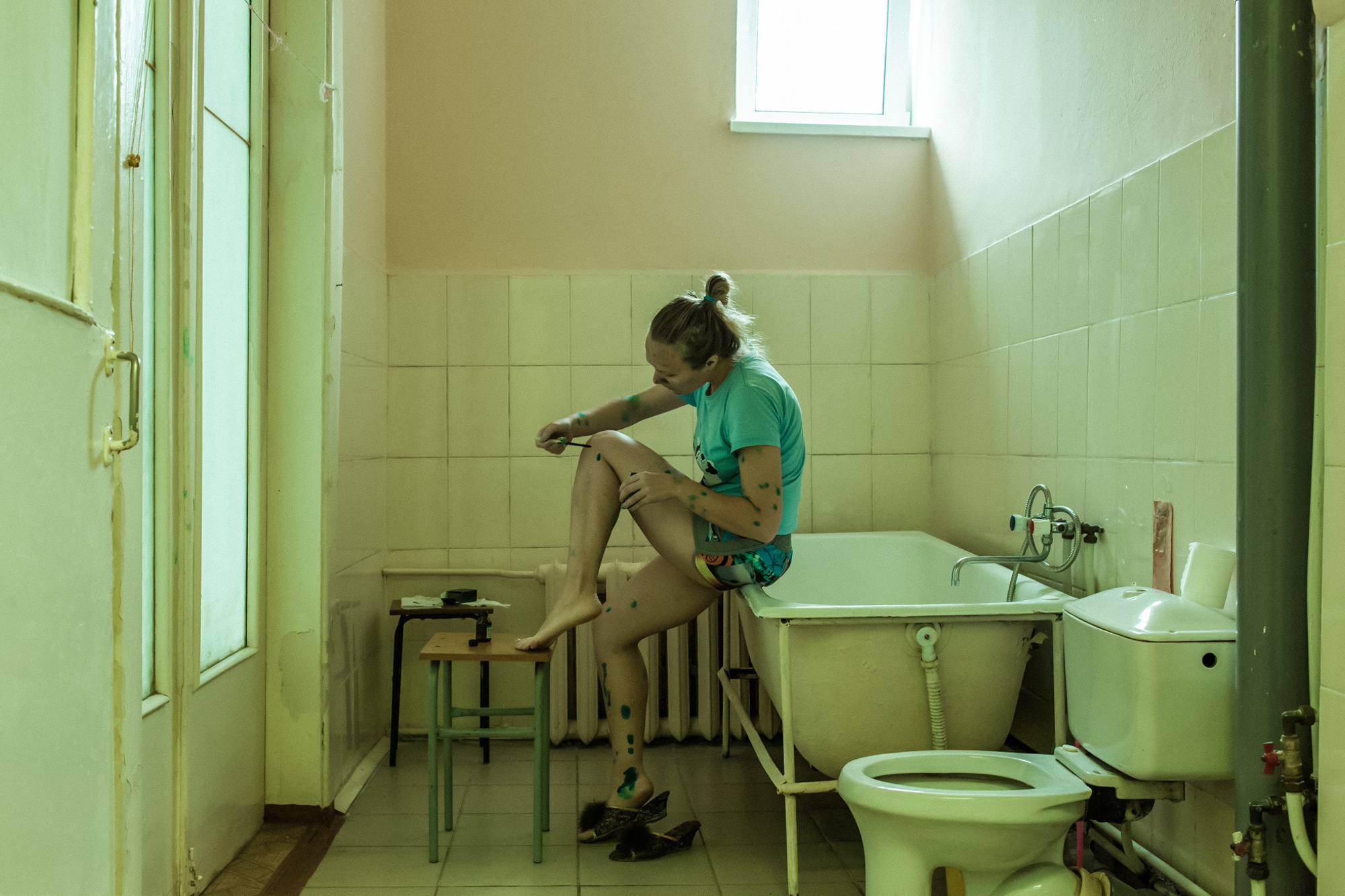 CHICKENPOX. Evgeniya Kokurina