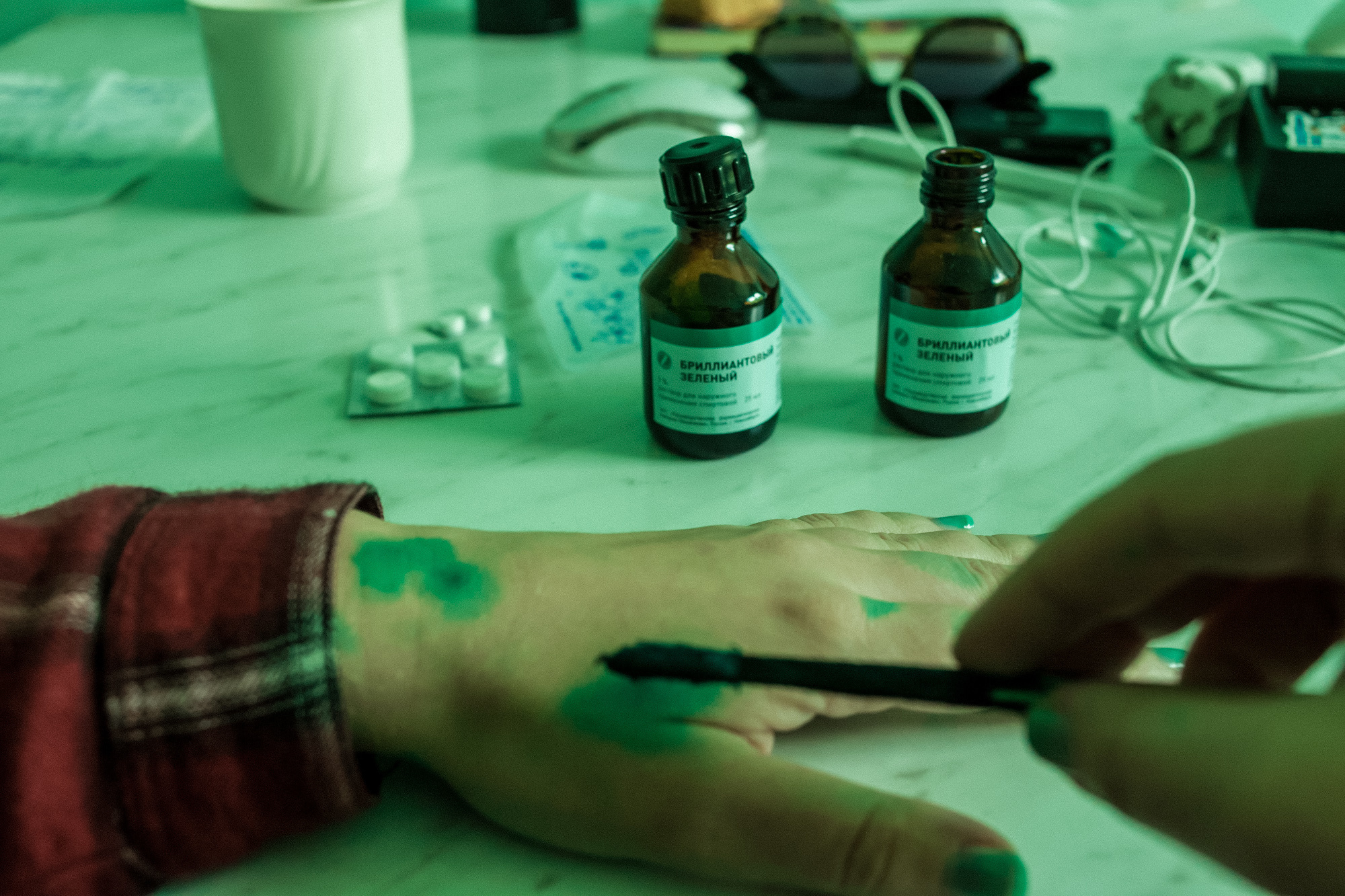 CHICKENPOX. Evgeniya Kokurina