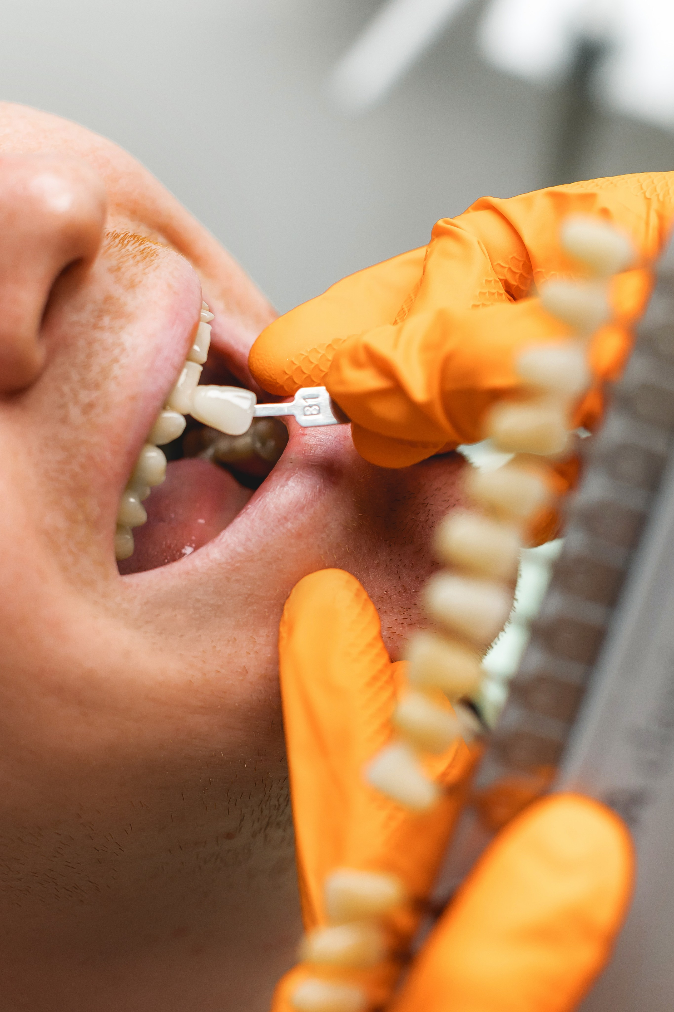 Стоматология. Семейный фотограф в Москве Татьяна Болтиева