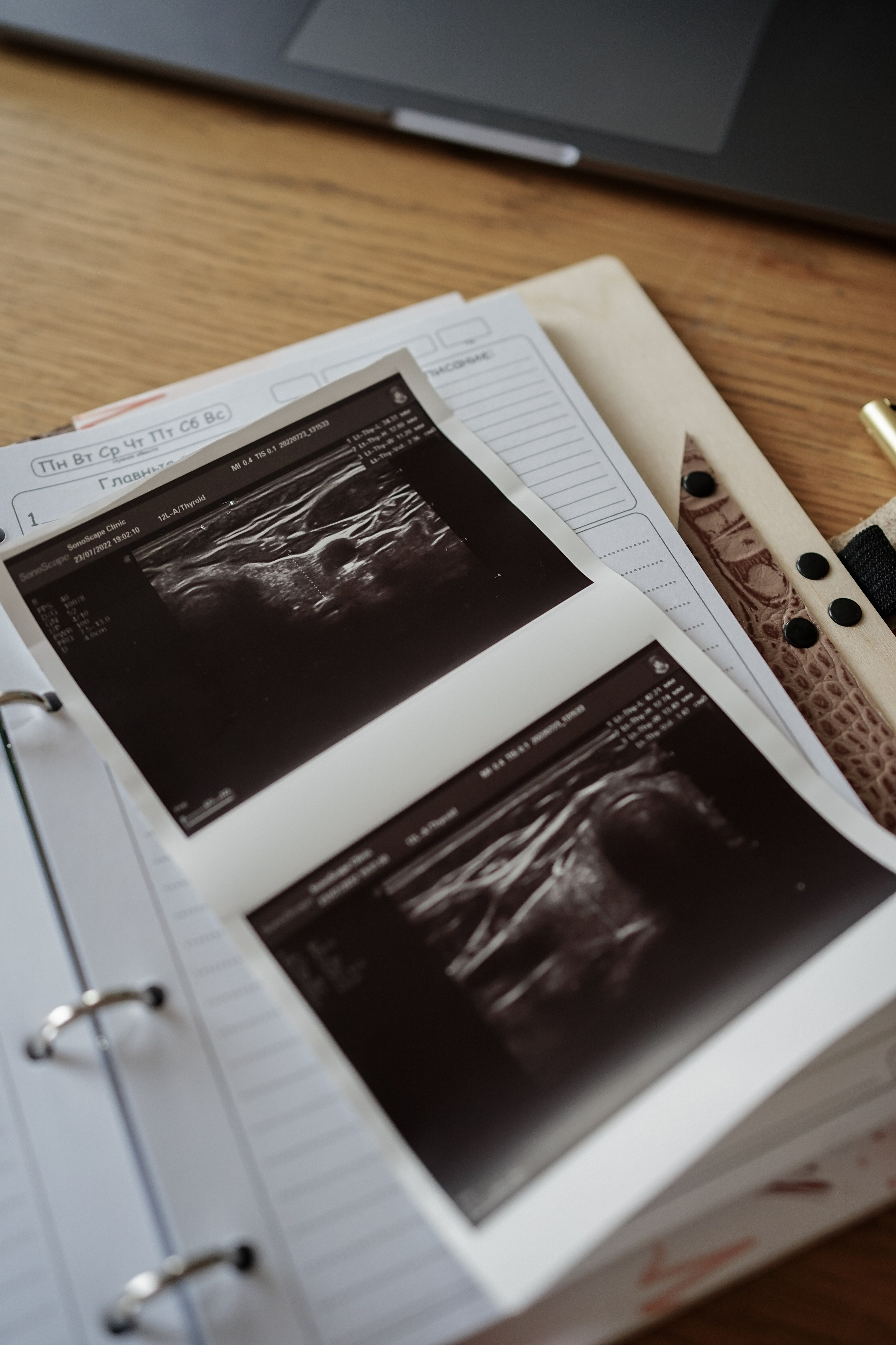 Гульнара Эндокринолог. Фотограф Ольга Игорева