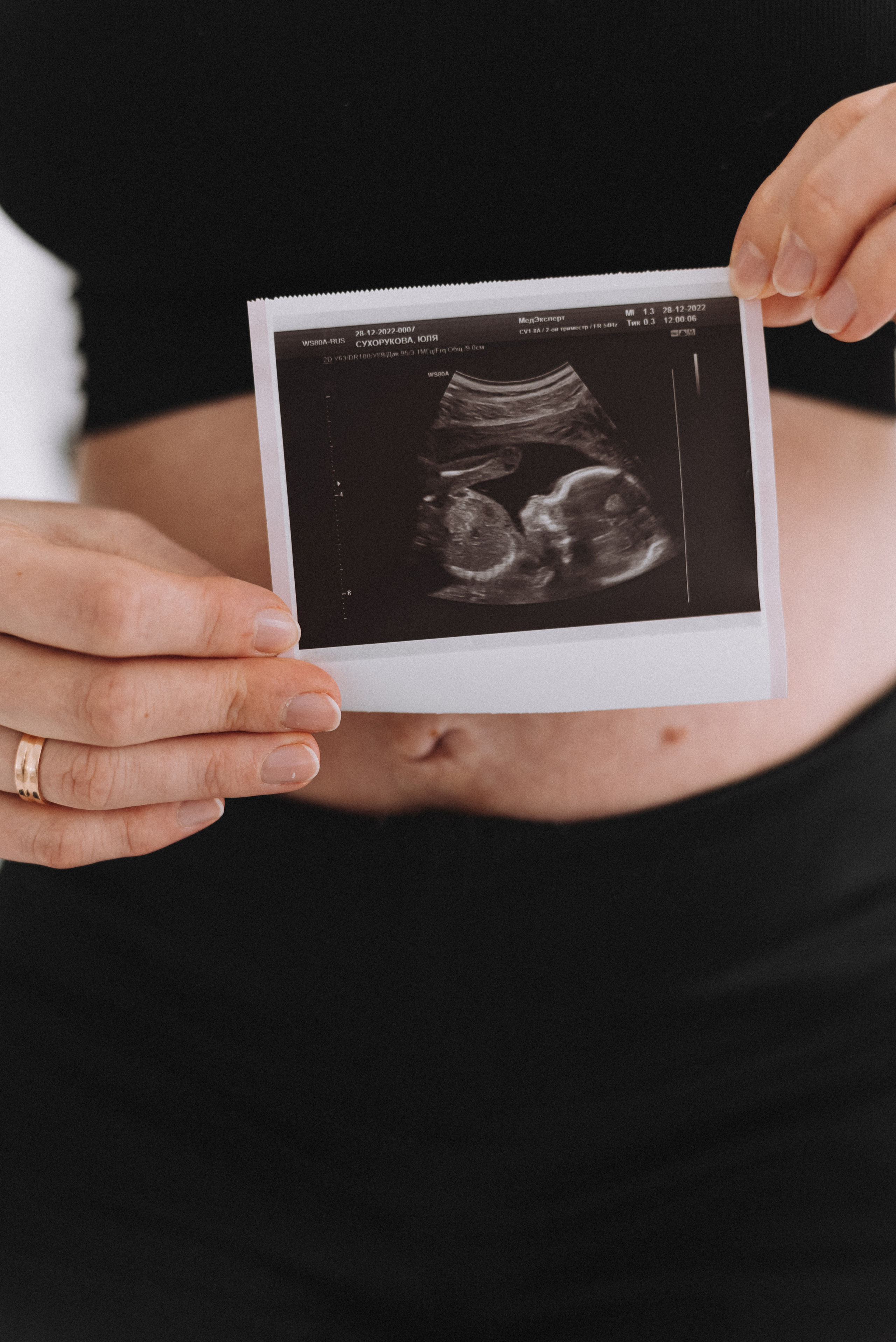 Наше чудо. Семейный и свадебный фотограф в Севастополе Лиза Печенько