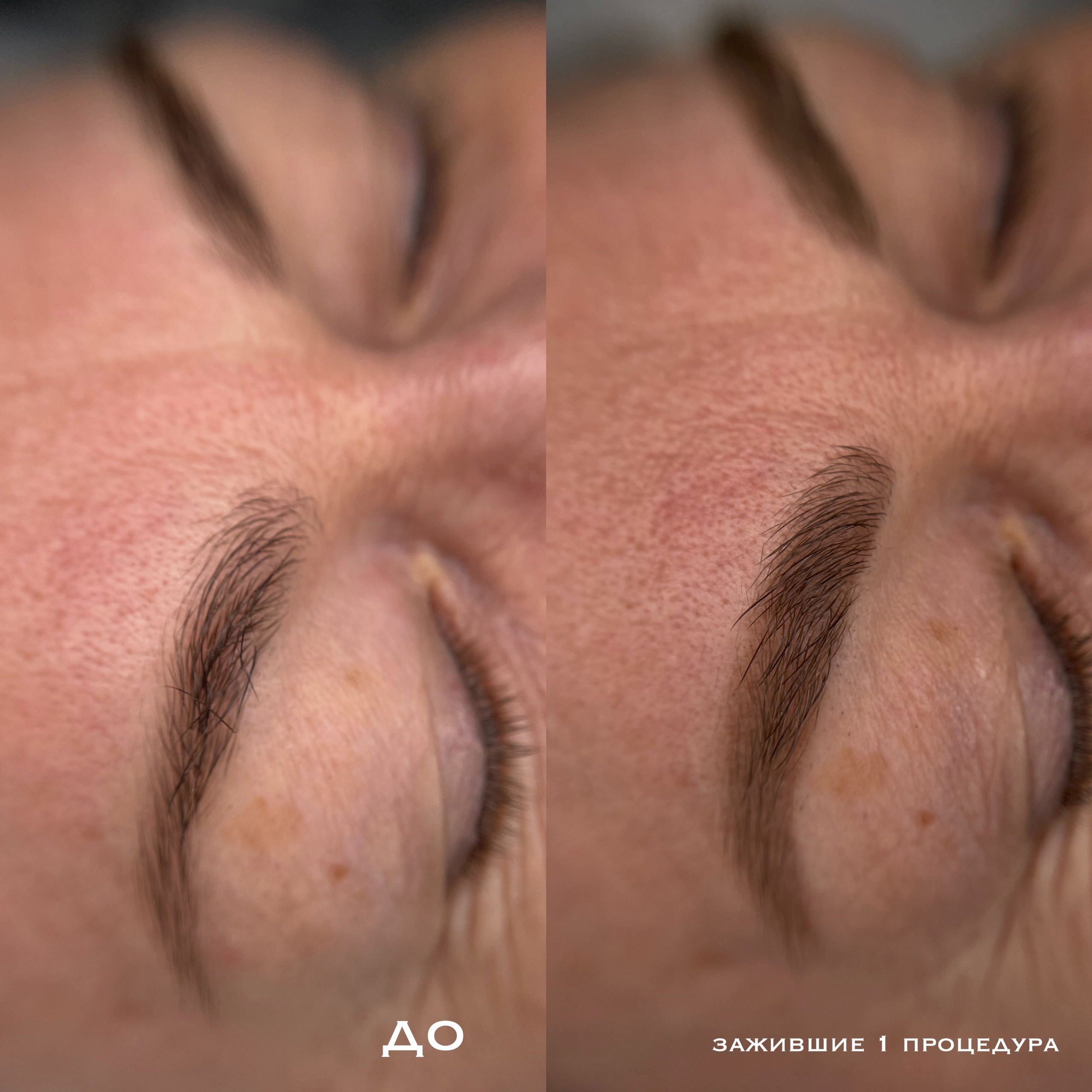 БРОВИ зажившие. Перманентный макияж и удаление старого татуажа в Ростове-на-Дону Дарья Исакова