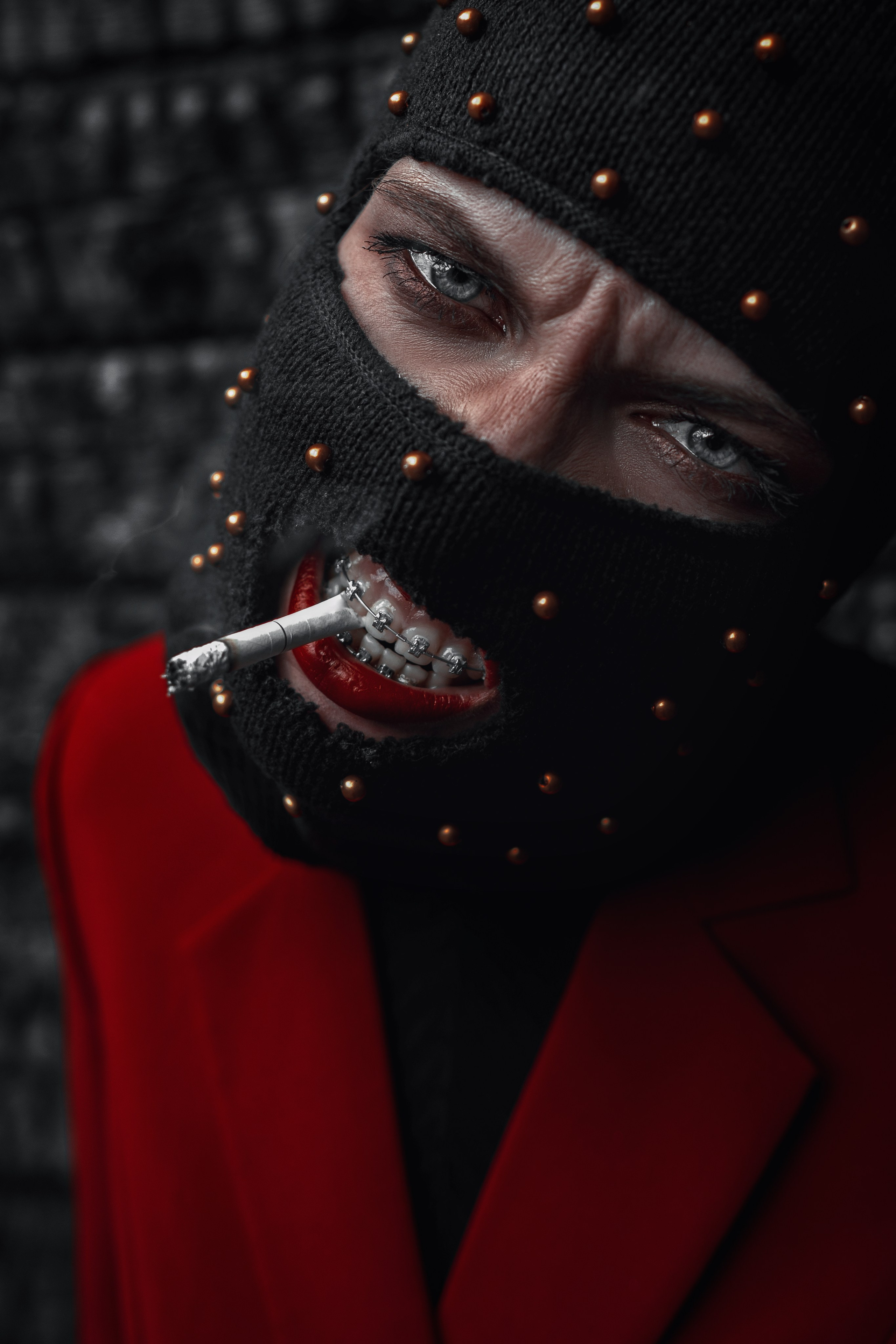 BRACES. Sergey,kuzichev