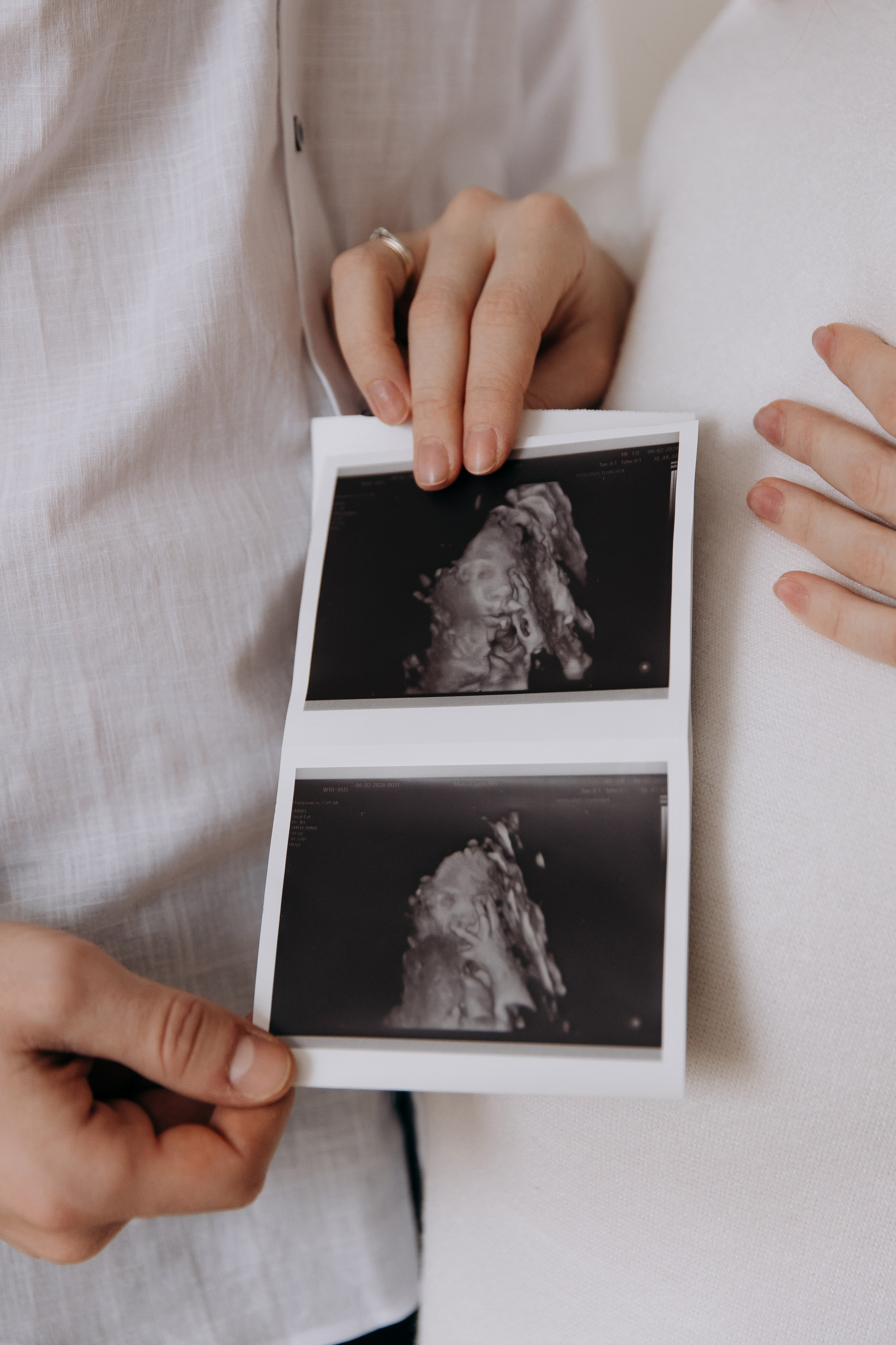 Сонет имени твоему. Свадебный фотограф в Москве Дмитрий Левин