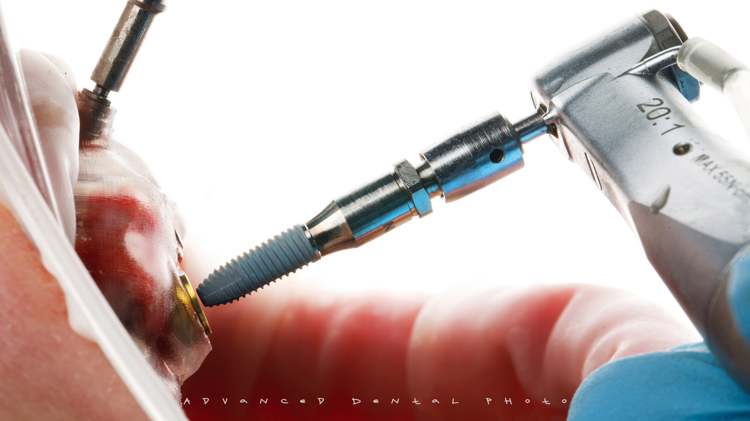 Хирургия. Дентал фотограф — видеограф Денис Дорошенко