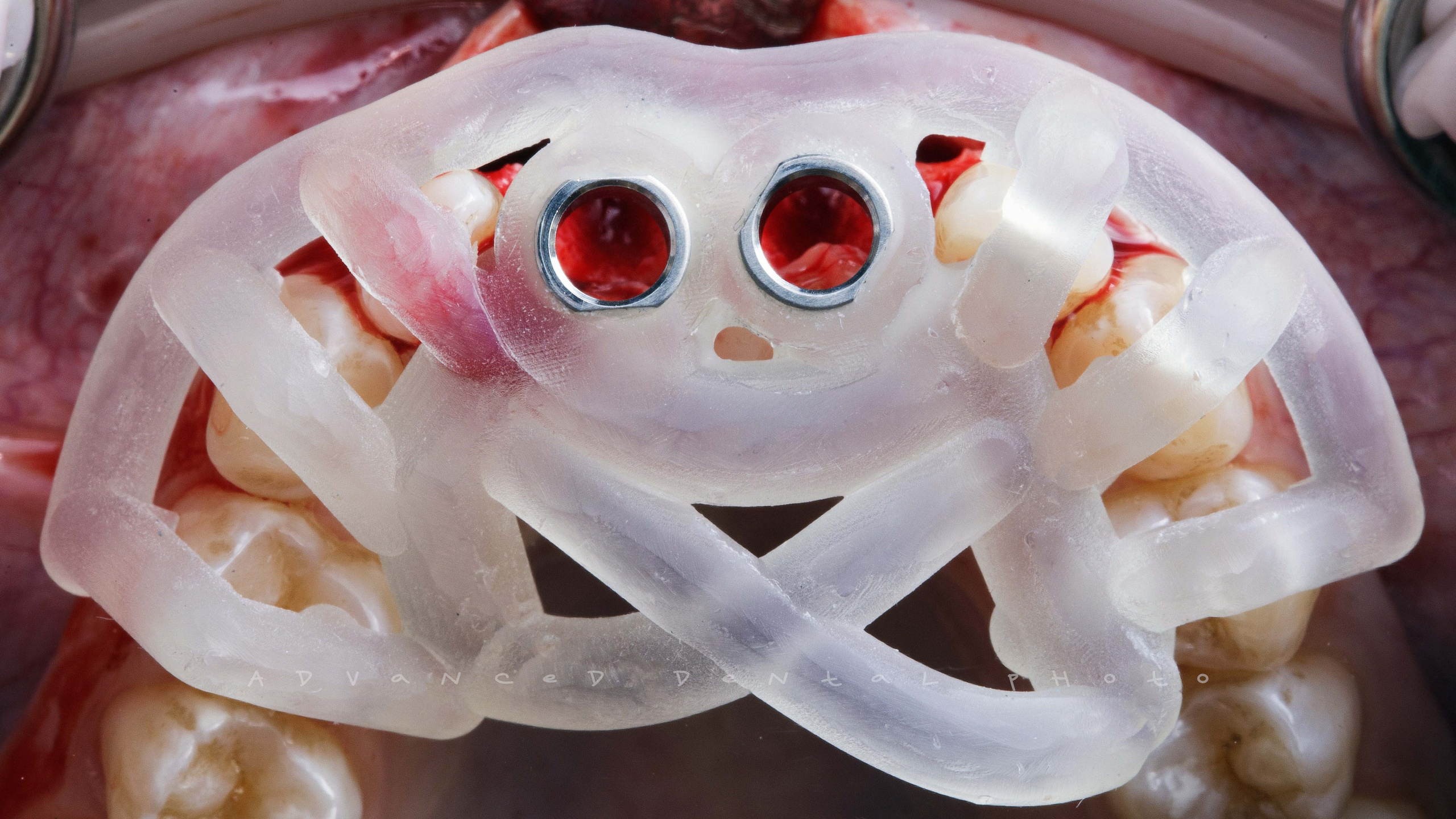 Дентал фотограф — видеограф Денис Дорошенко