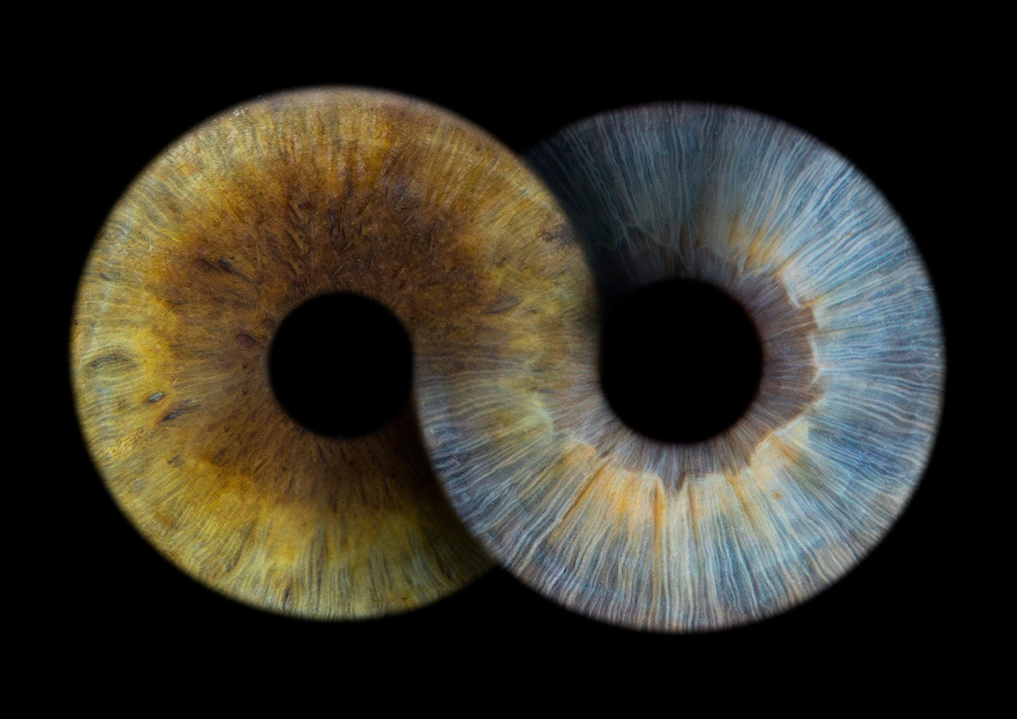 Примеры фото. Фото радужки глаза LOOK IN