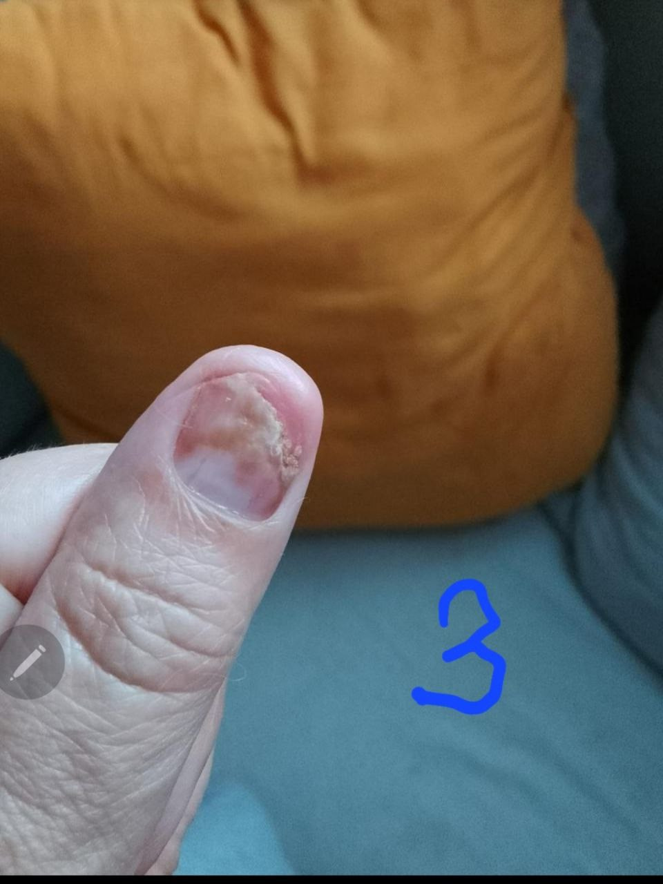 Результаты. Biogenial — Живая формула. Научная точность. Реальное восстановление