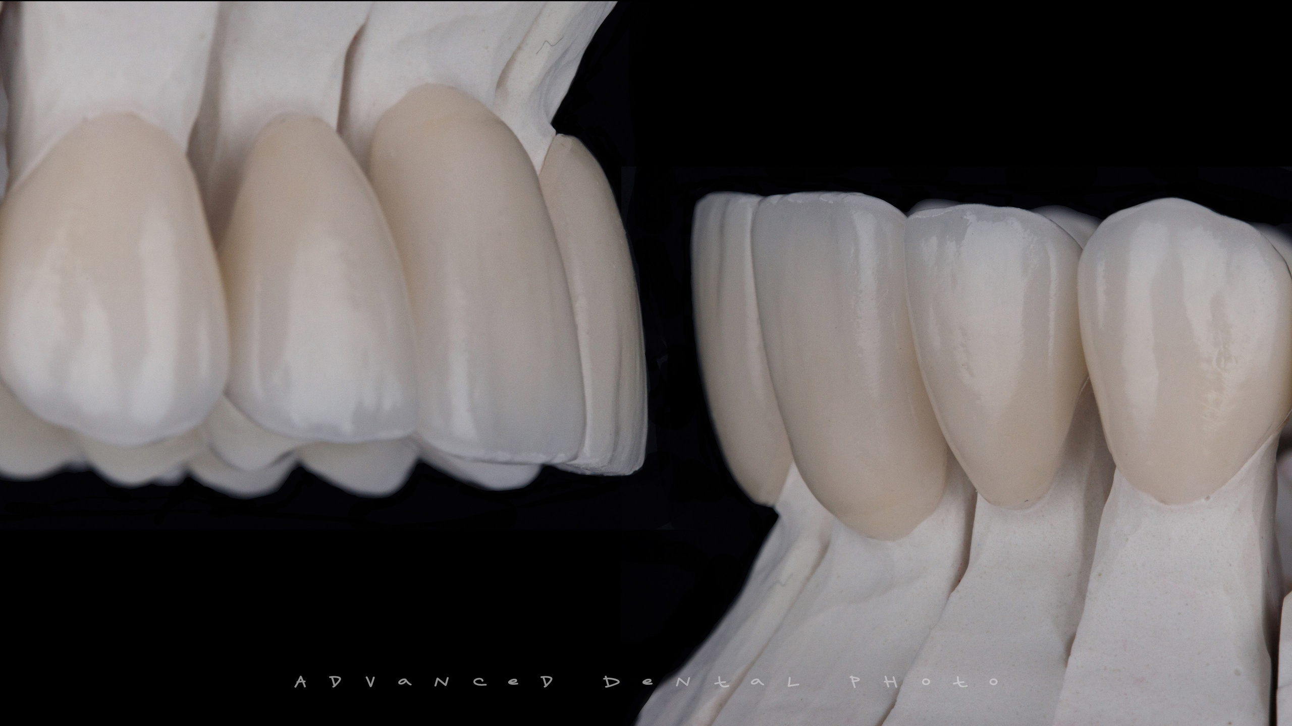 Предметная съёмка. Дентал фотограф — видеограф Денис Дорошенко