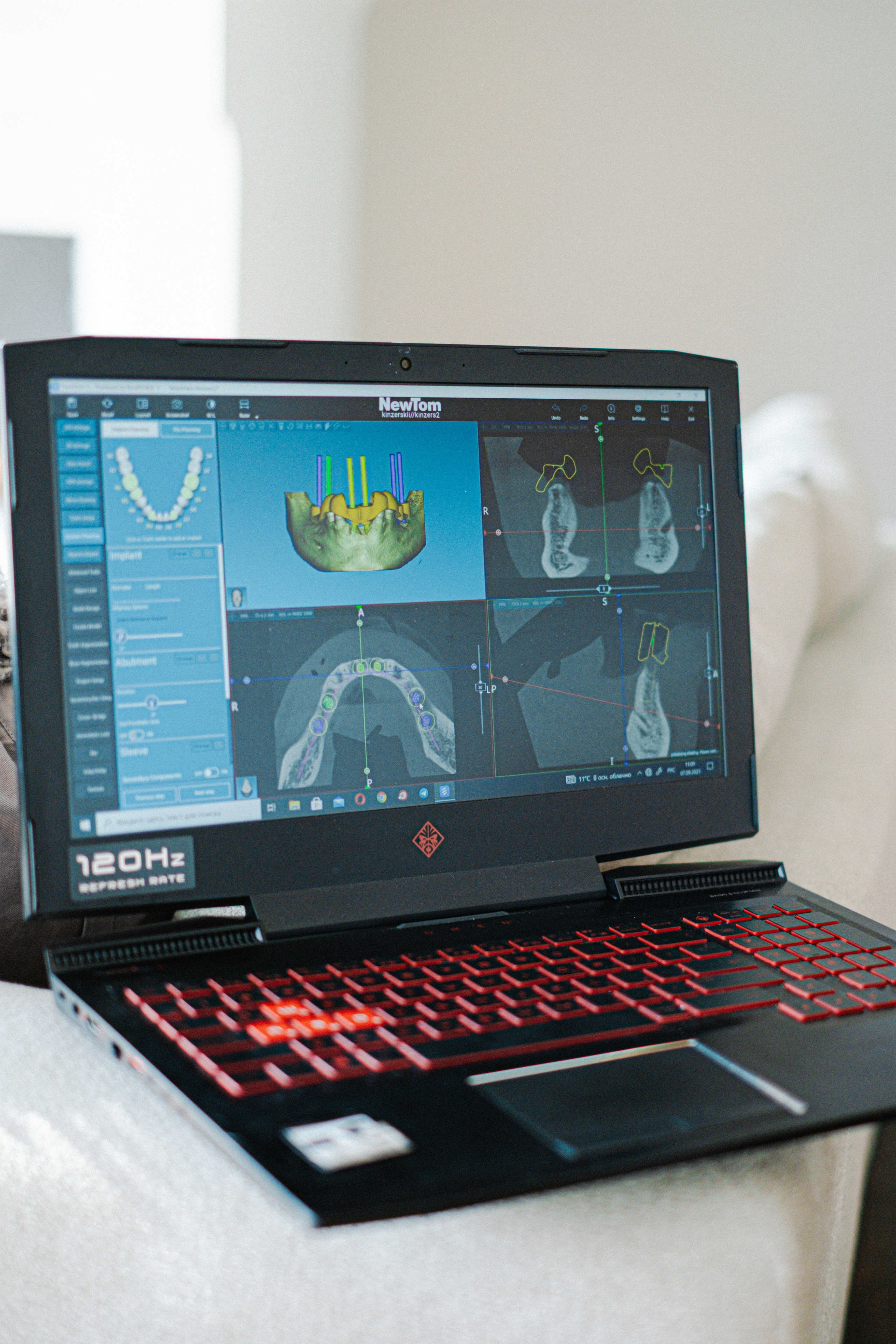 Фотоконтент стоматолога. Свадебный и семейный фотограф в Санкт-Петербурге Светлана Лантратова