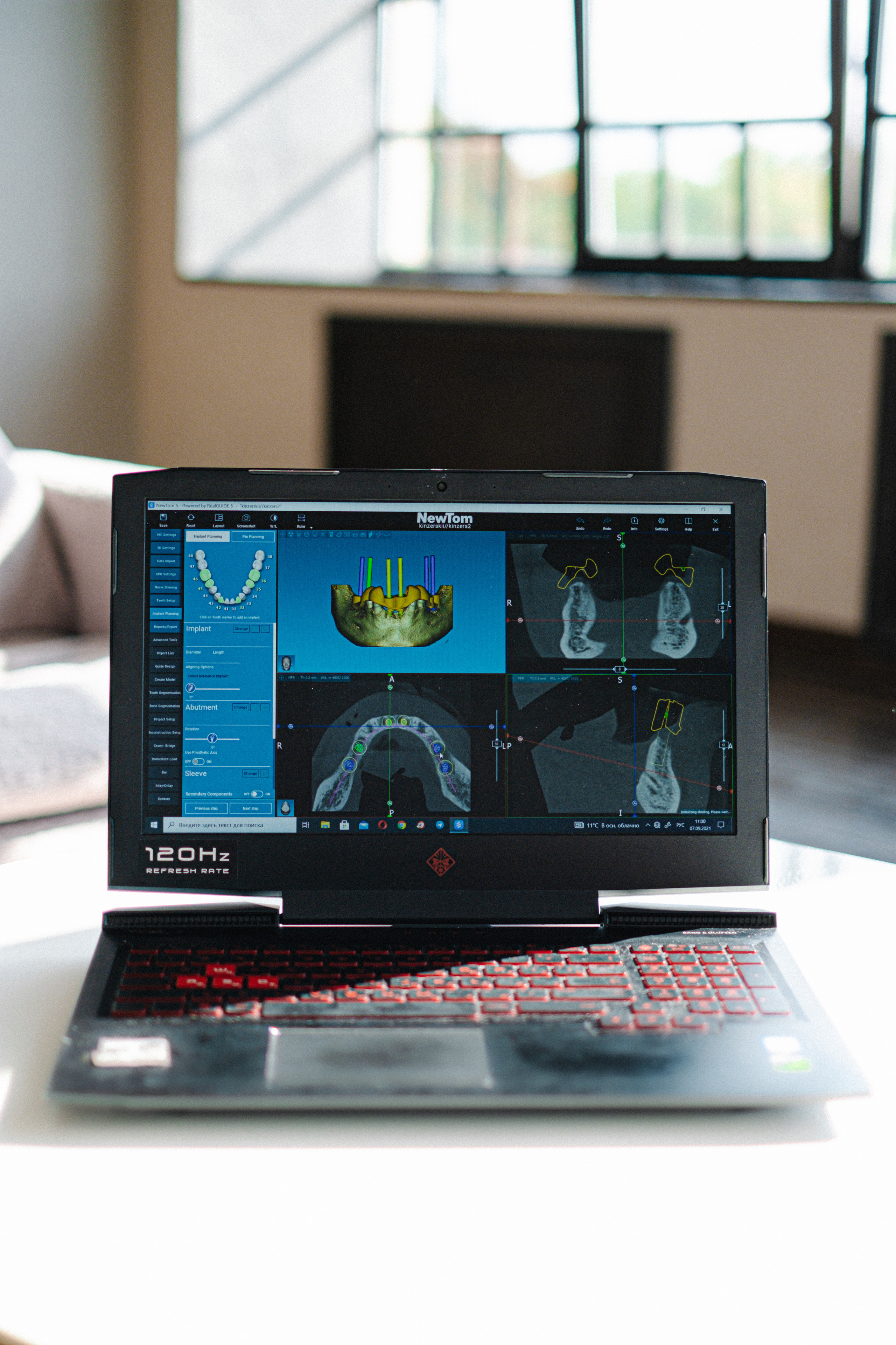 Фотоконтент стоматолога. Свадебный и семейный фотограф в Санкт-Петербурге Светлана Лантратова