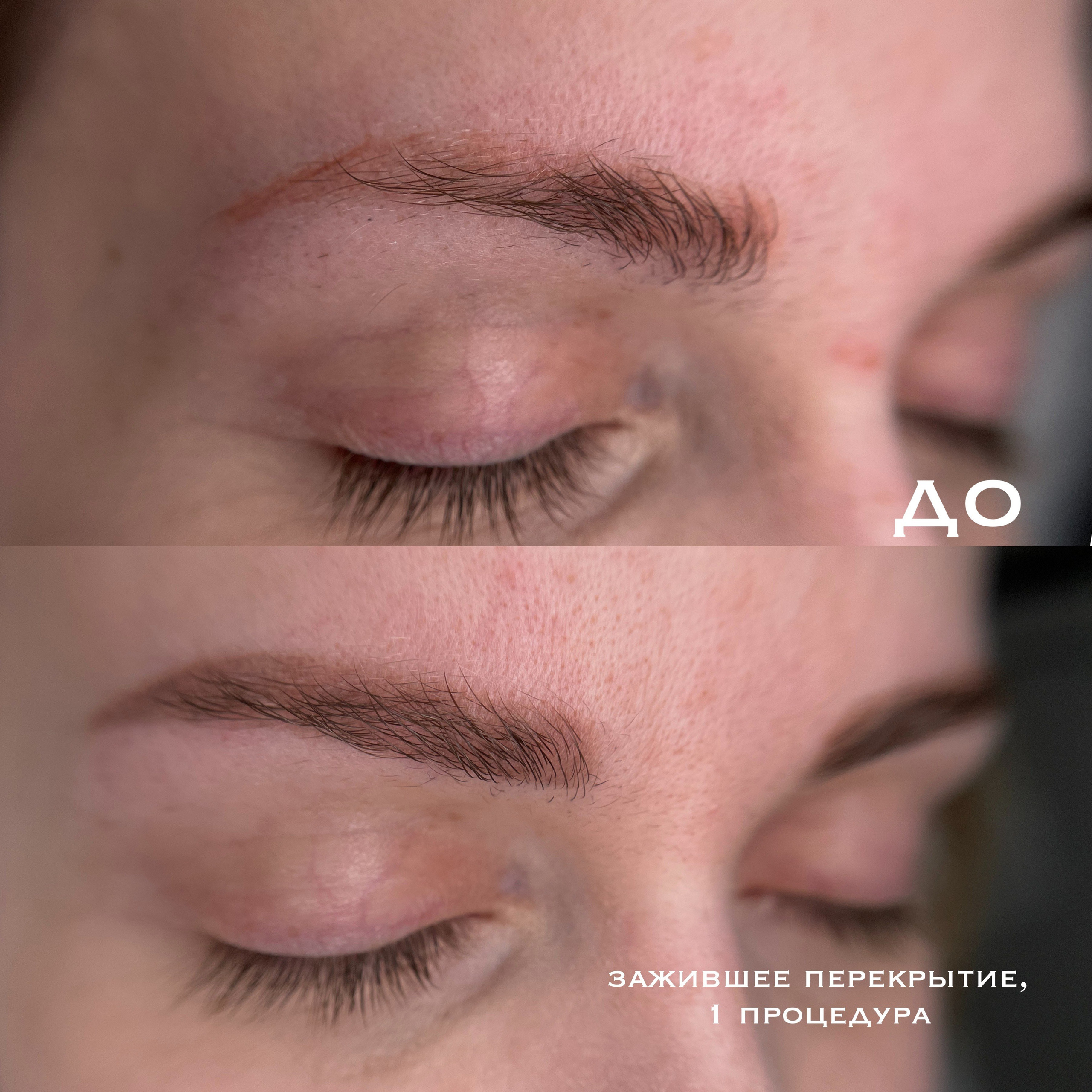БРОВИ зажившие. Перманентный макияж и удаление старого татуажа в Ростове-на-Дону Дарья Исакова