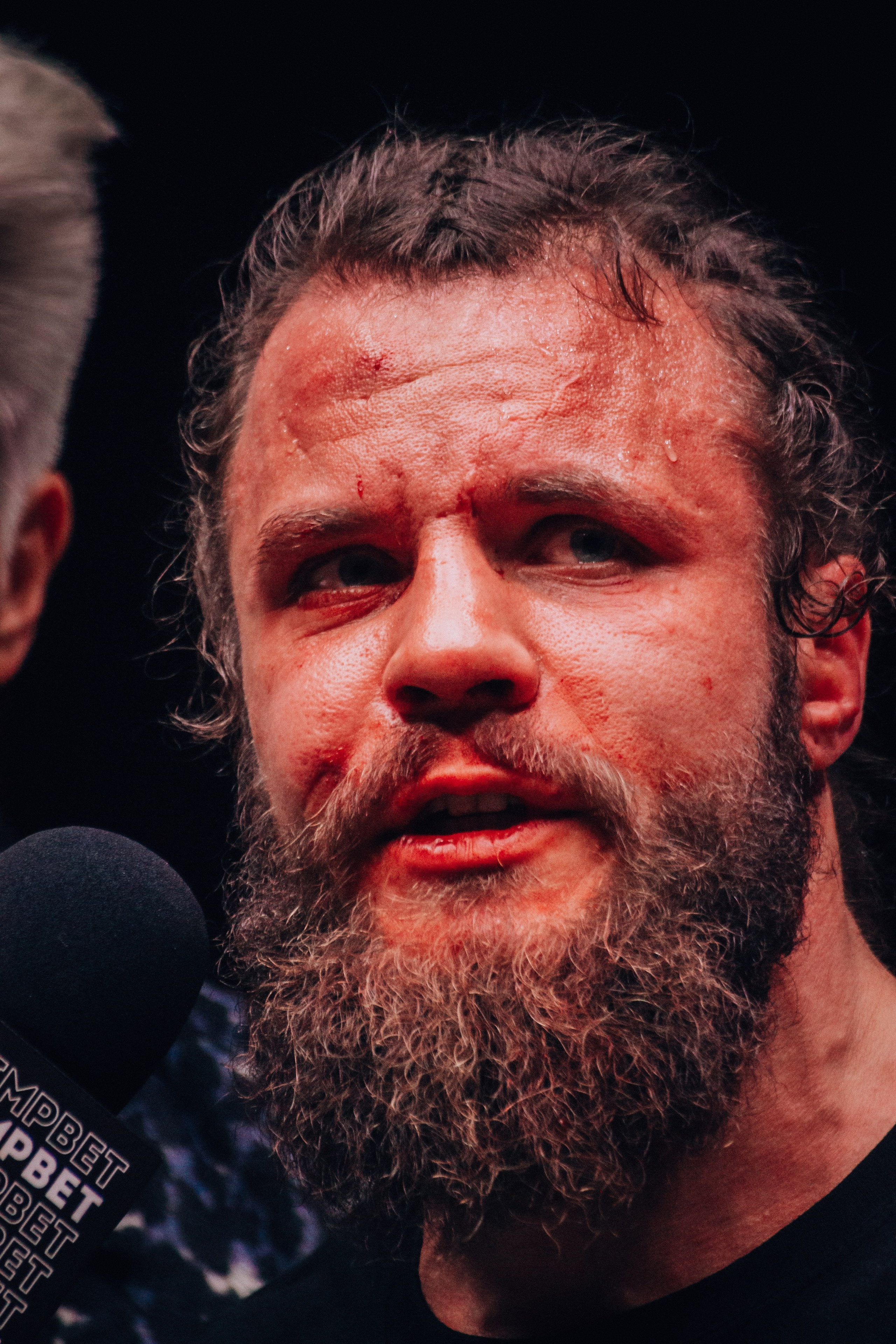 Кулачные бои TopDog. Анастасия Тен