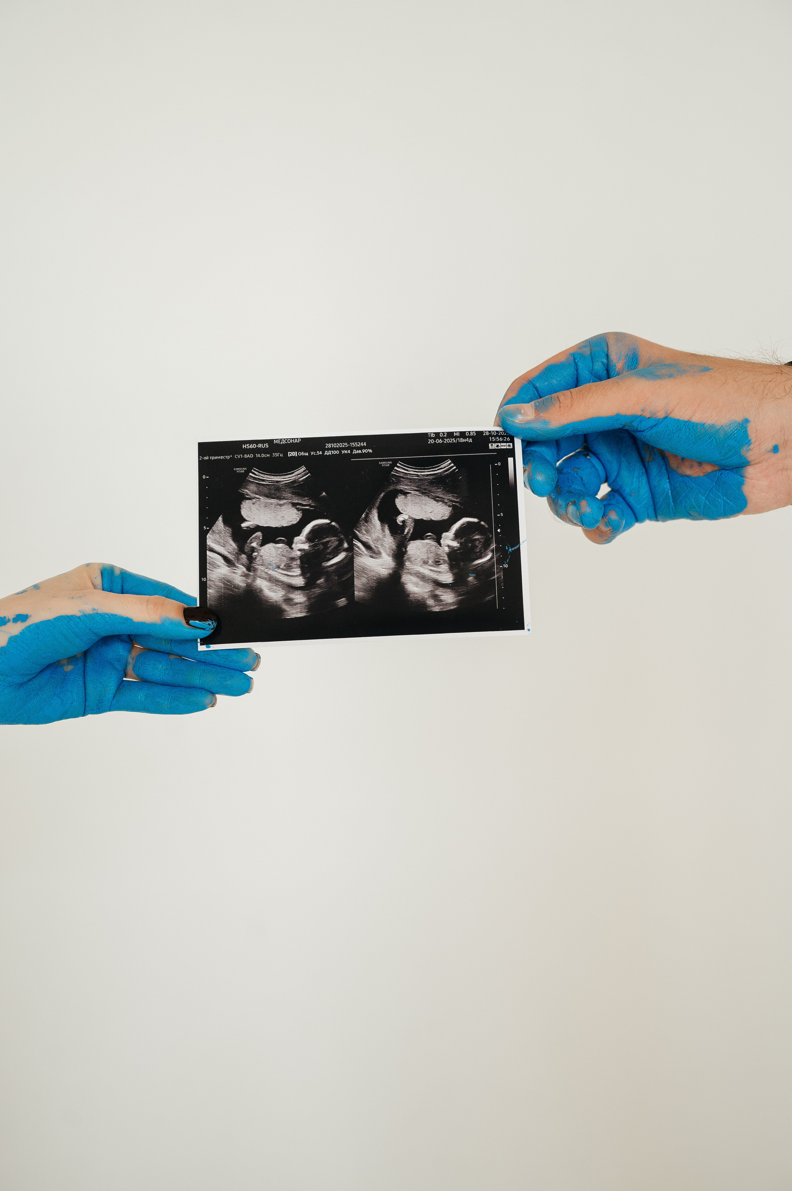 Гендер пати 🤍. Свадебный и семейный фотограф в Краснодаре Алина Мельник