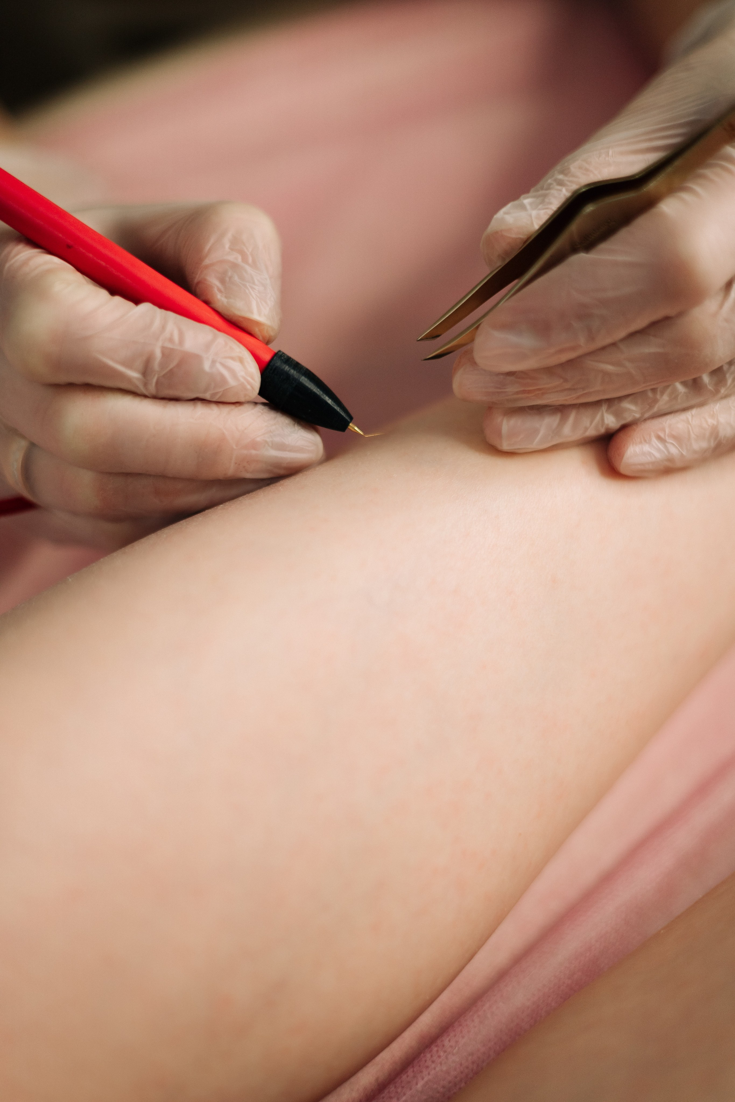 Студия лазерной эпиляции