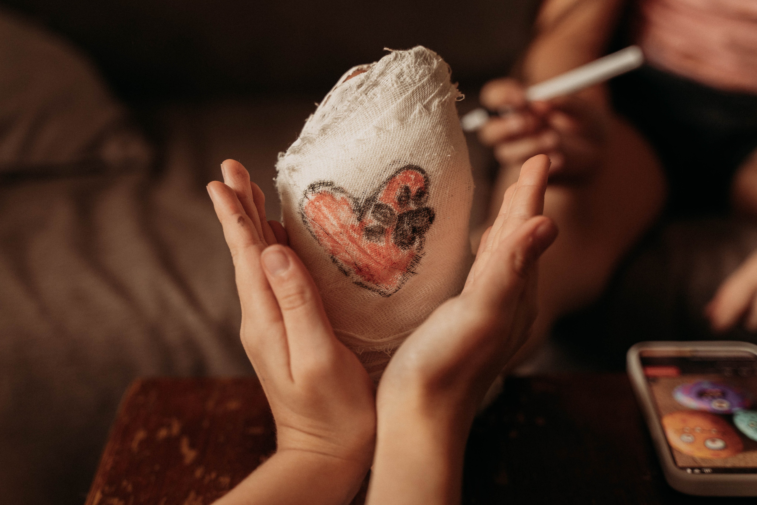 Устя и гипс. Семейный фотограф в Москве Алёна Шестунова