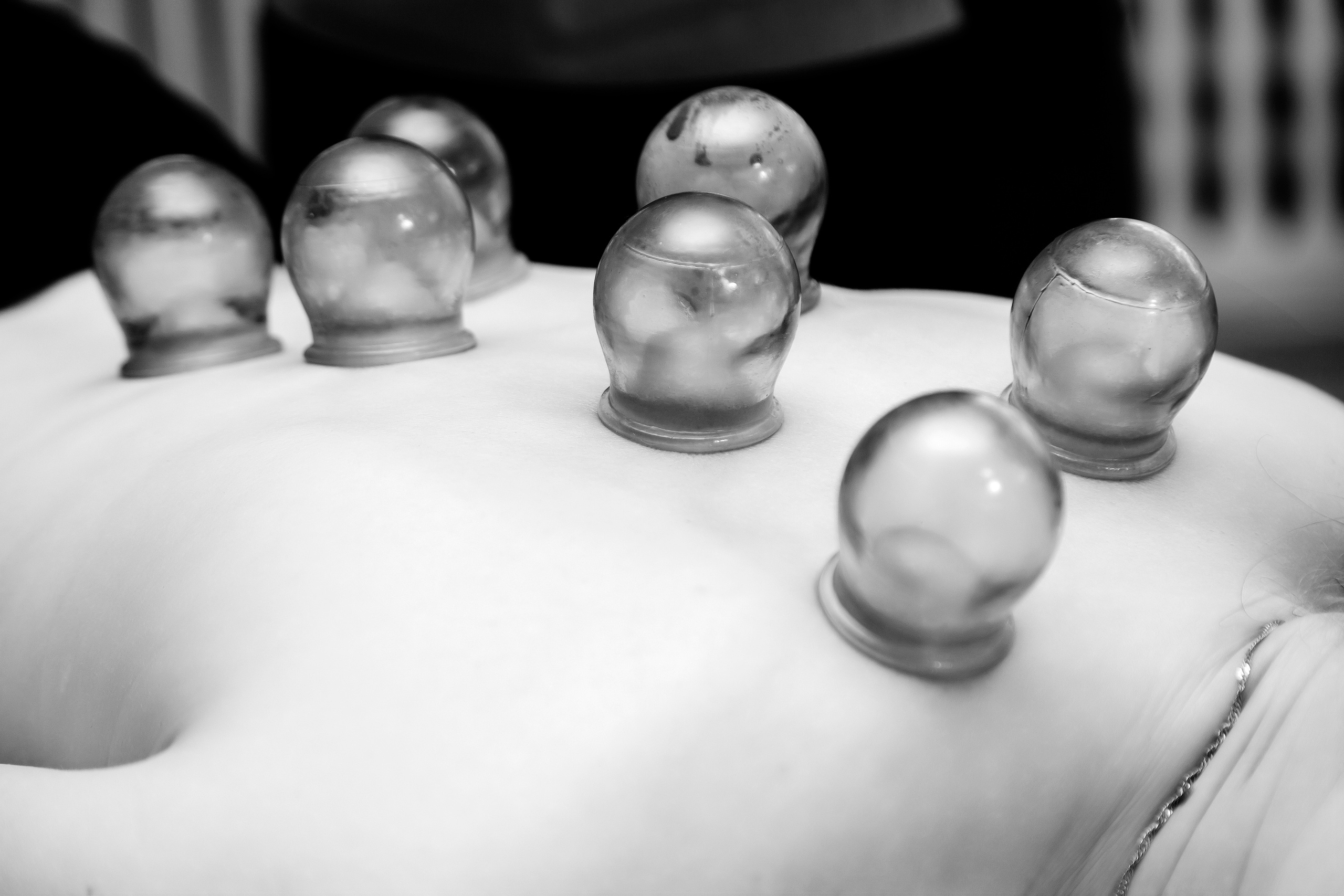 Банки и массаж. Фотограф Андрей Гузеев