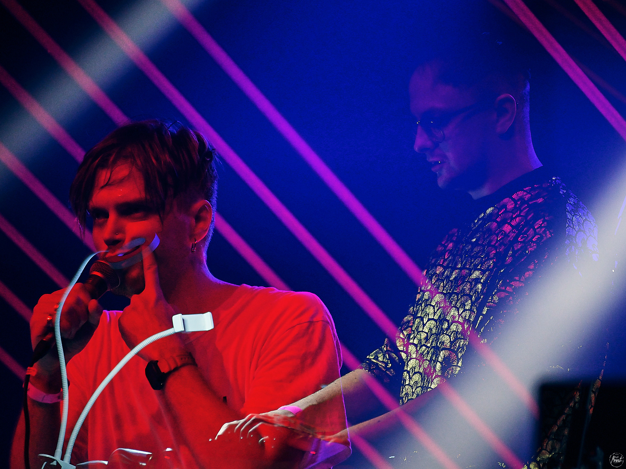 Электрофорез. Фотографии отовсюду и обо всем