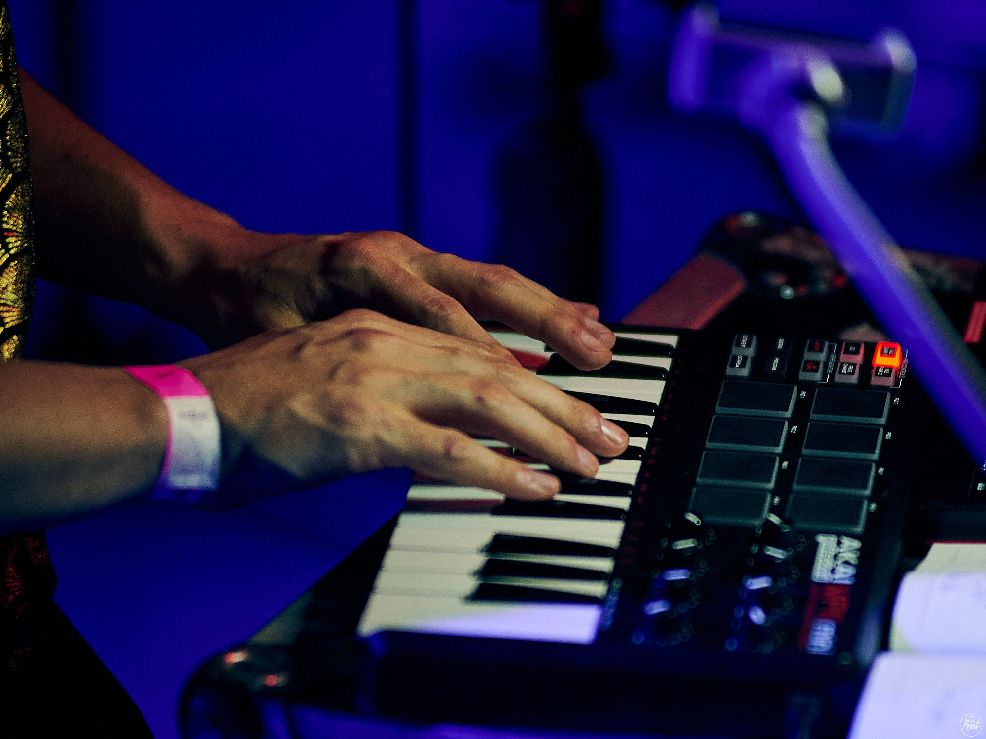 Электрофорез. Фотографии отовсюду и обо всем