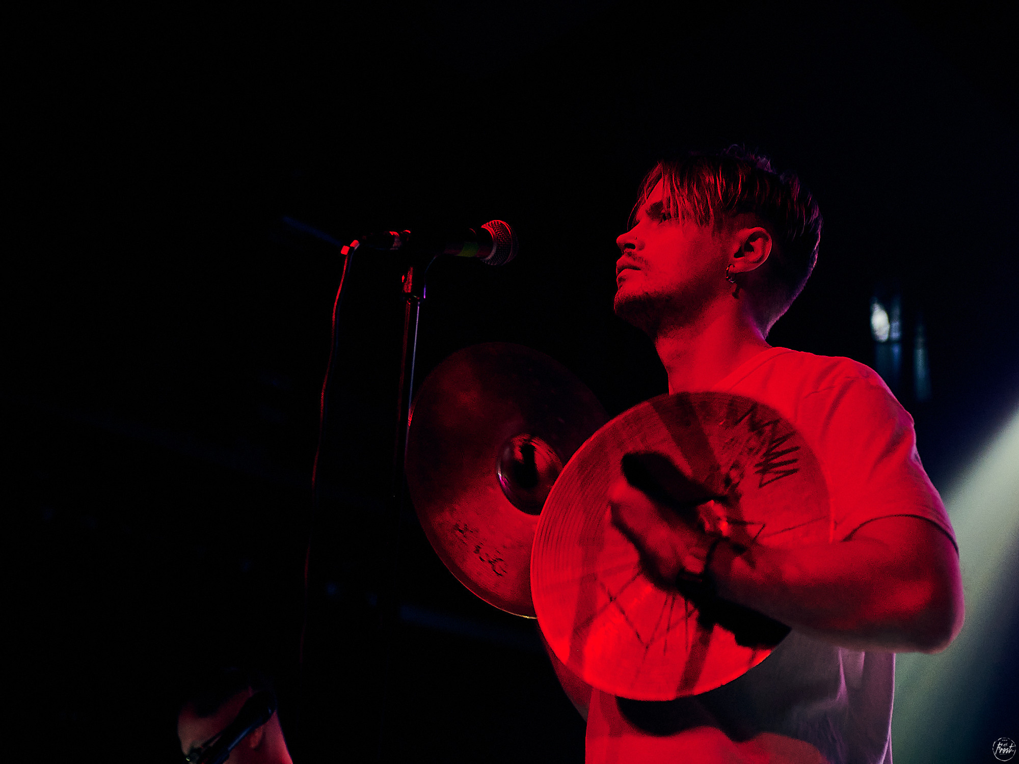 Электрофорез. Фотографии отовсюду и обо всем