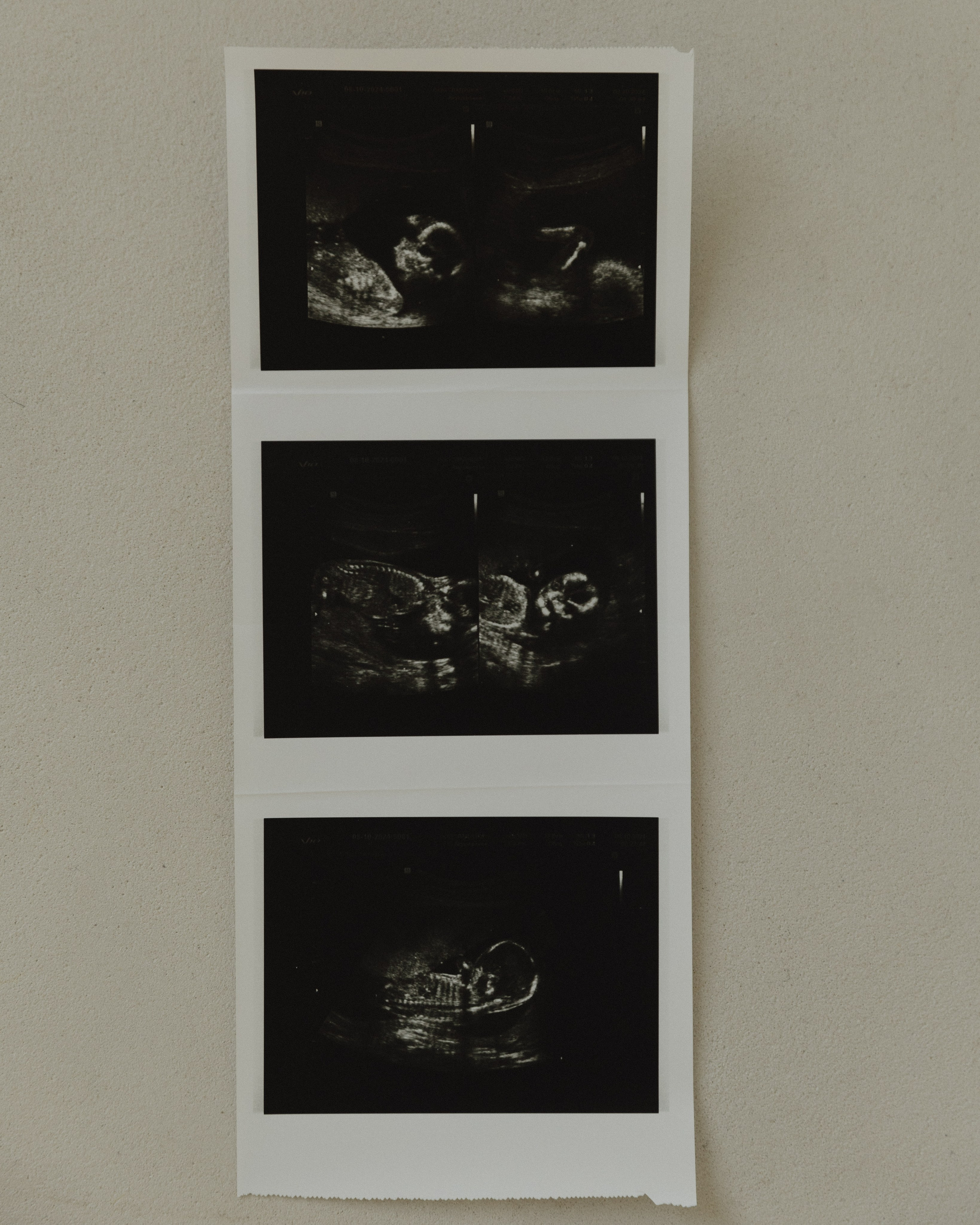 Мы тебя очень ждем…